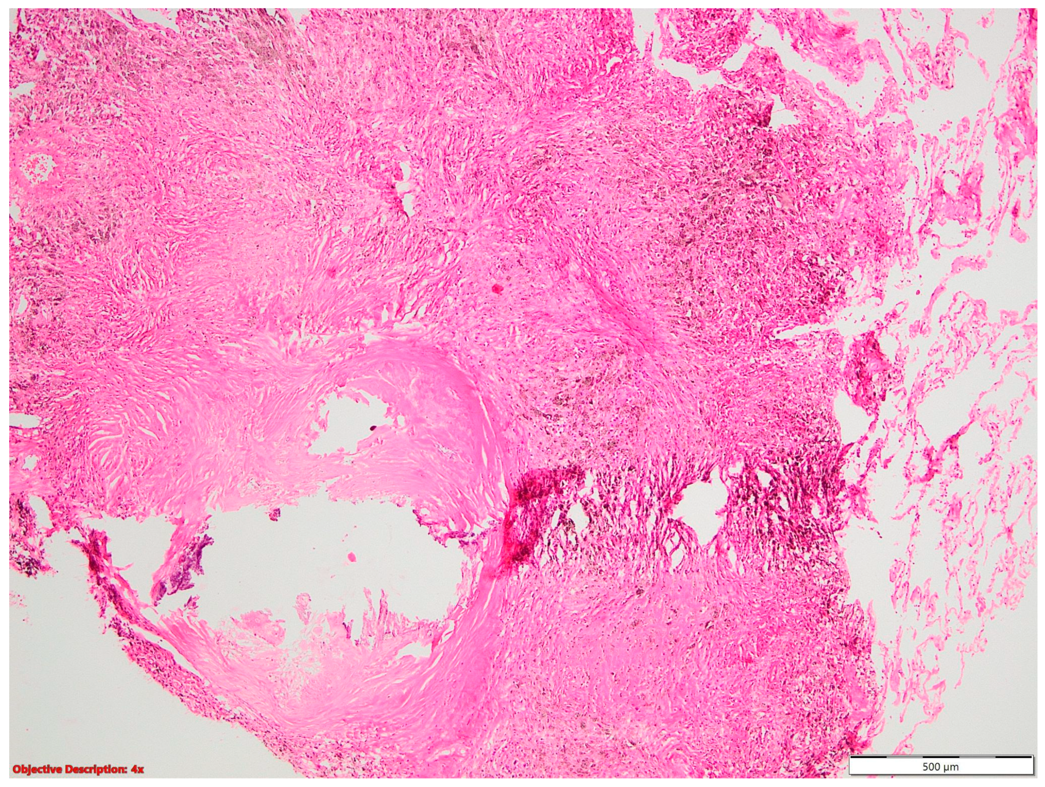 Cancers 16 01903 g004 Cancers 16 01903 g004