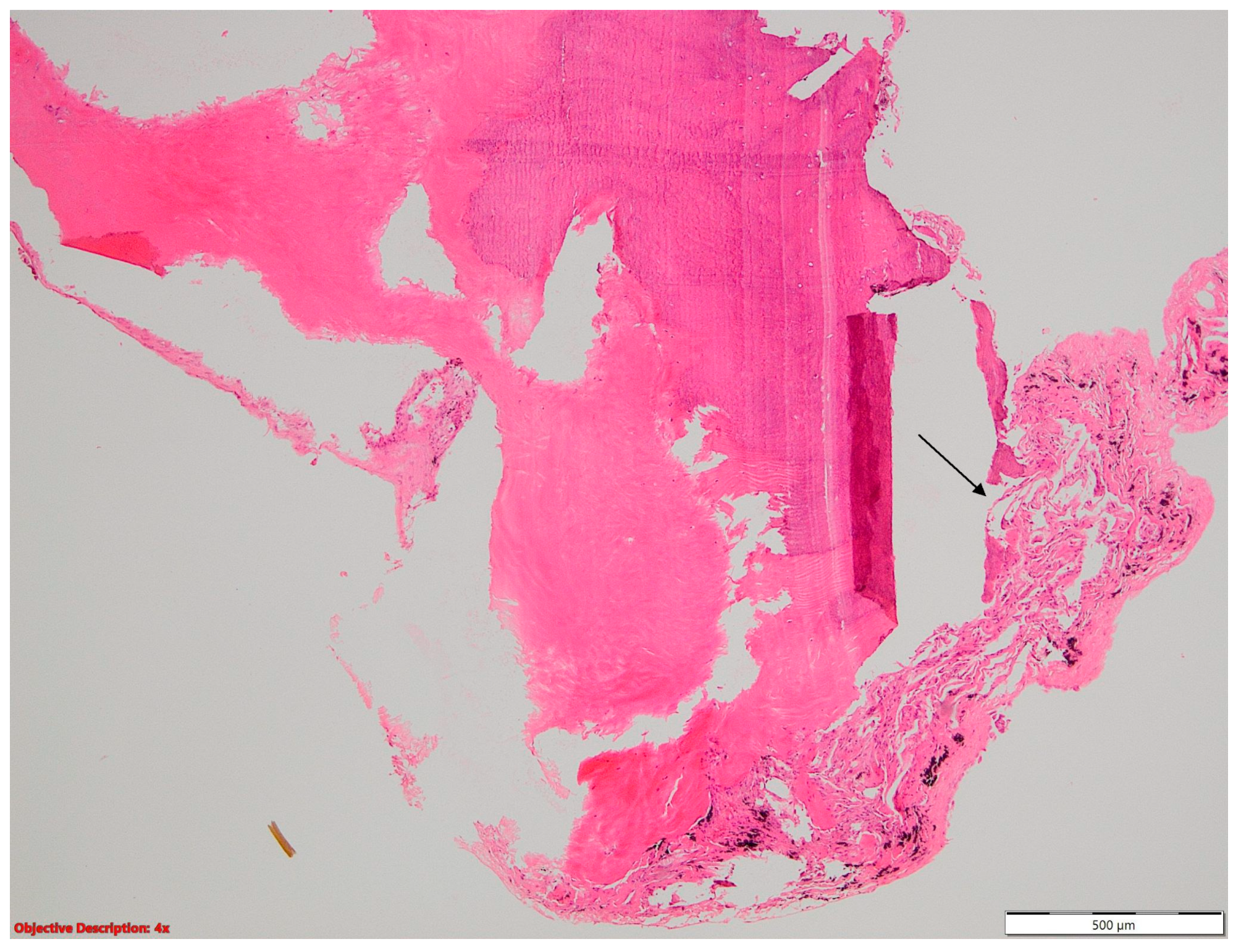 Cancers 16 01903 g005 Cancers 16 01903 g005