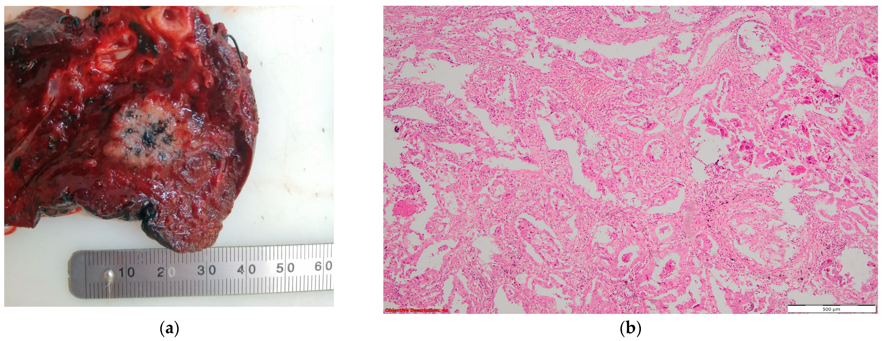 Cancers 16 01903 g006 Cancers 16 01903 g006