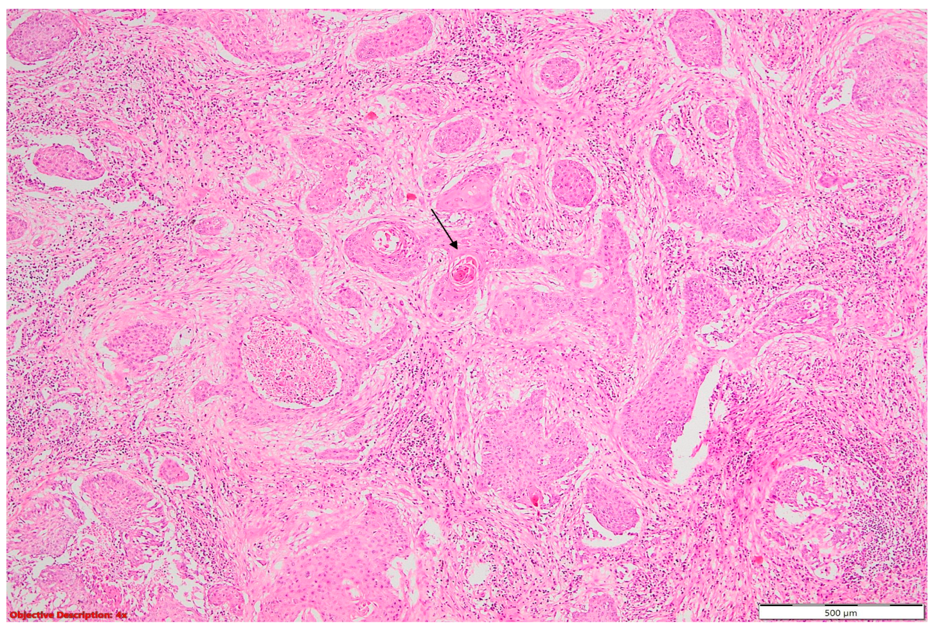 Cancers 16 01903 g007 Cancers 16 01903 g007