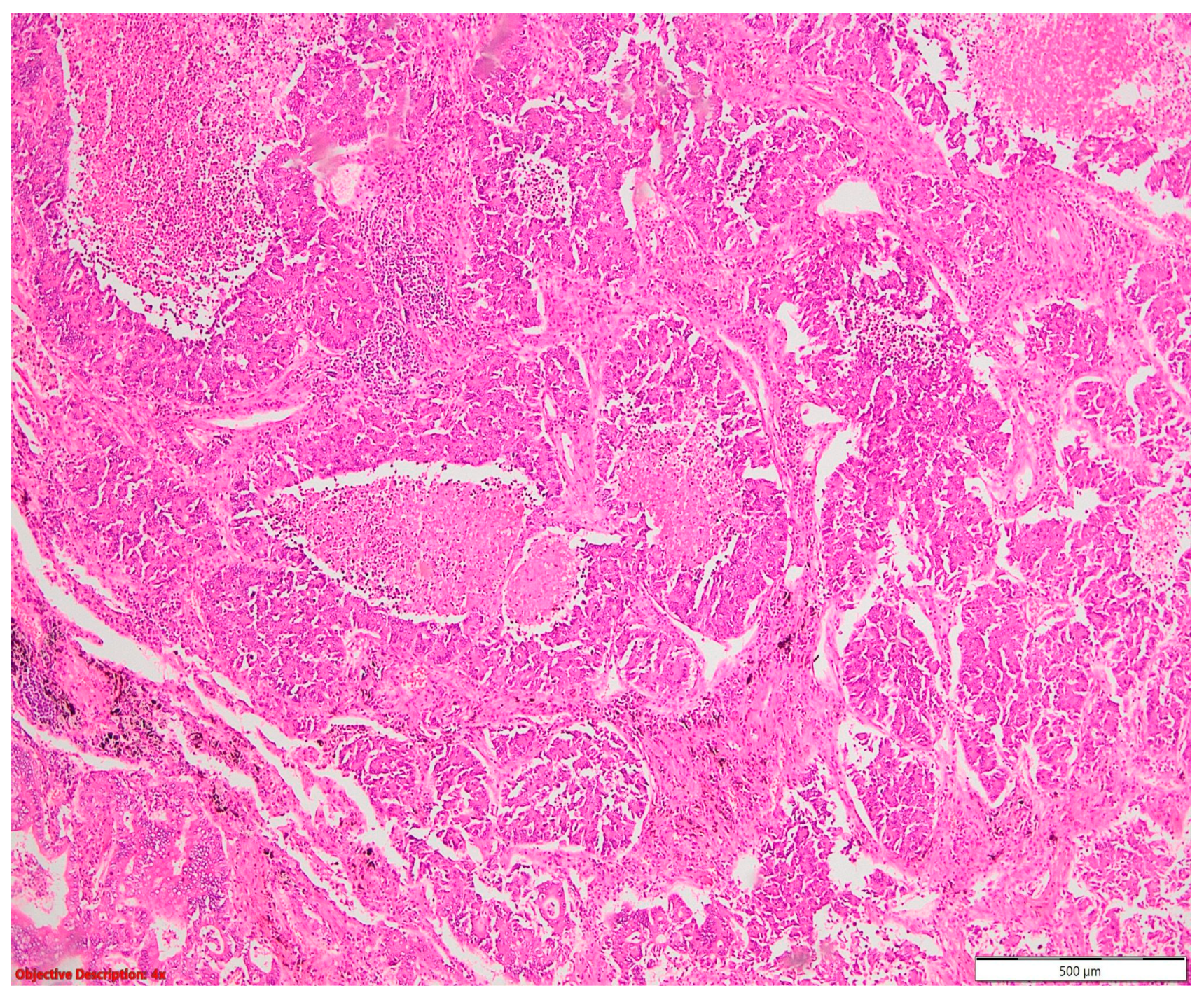 Cancers 16 01903 g008 Cancers 16 01903 g008