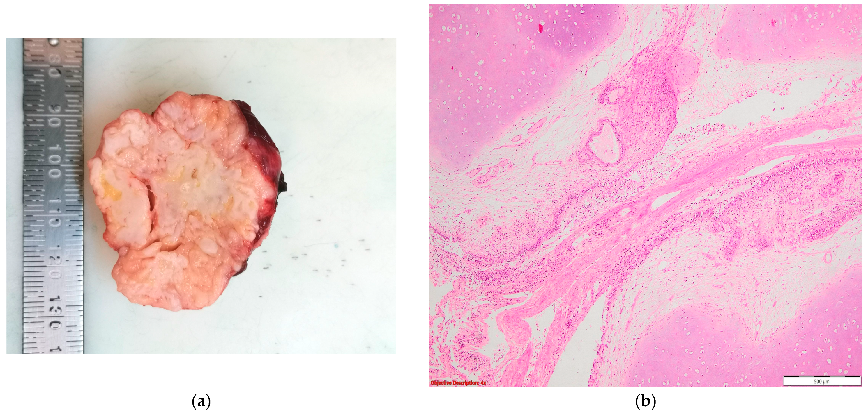 Cancers 16 01903 g009 Cancers 16 01903 g009