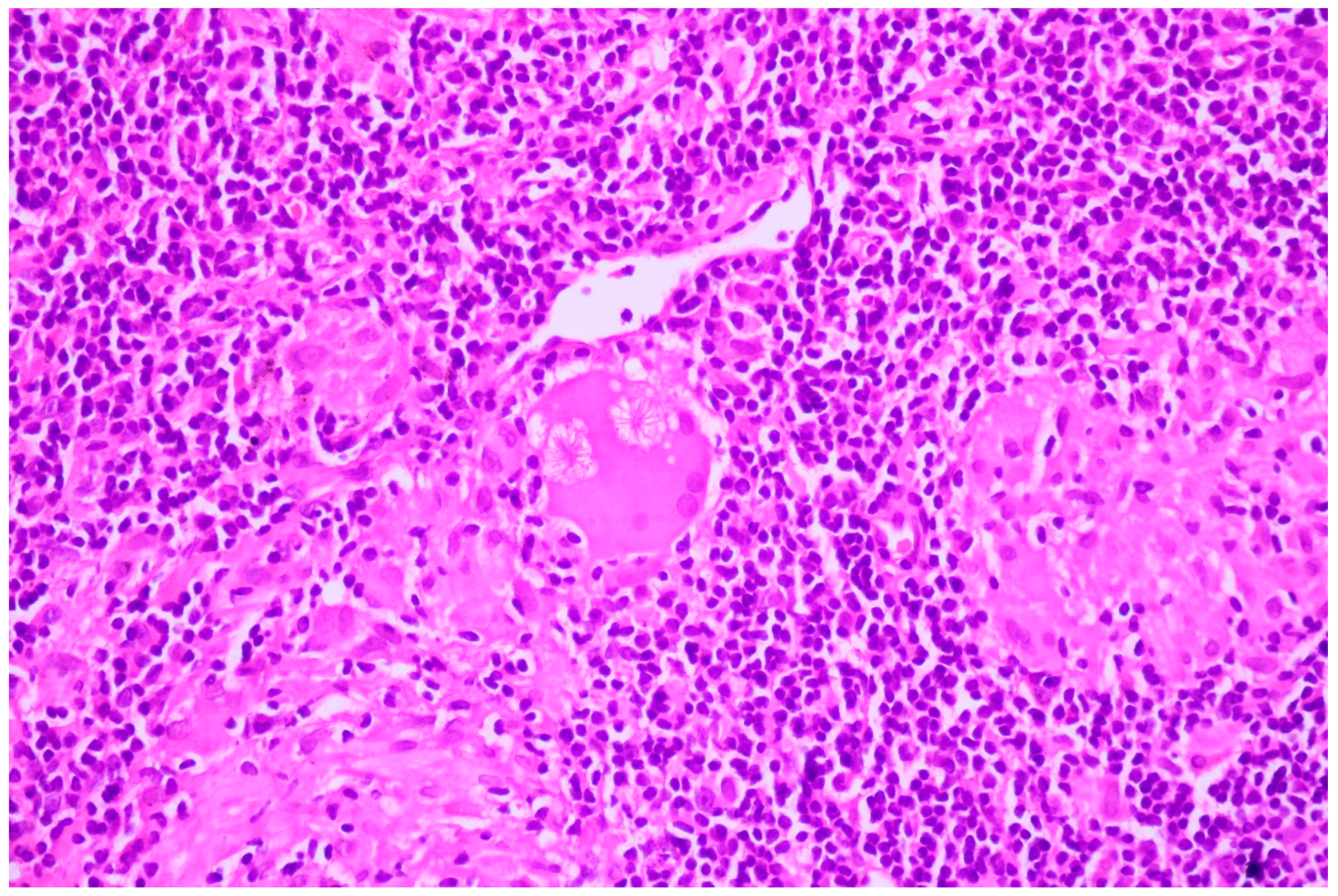 Cancers 16 01903 g011 Cancers 16 01903 g011