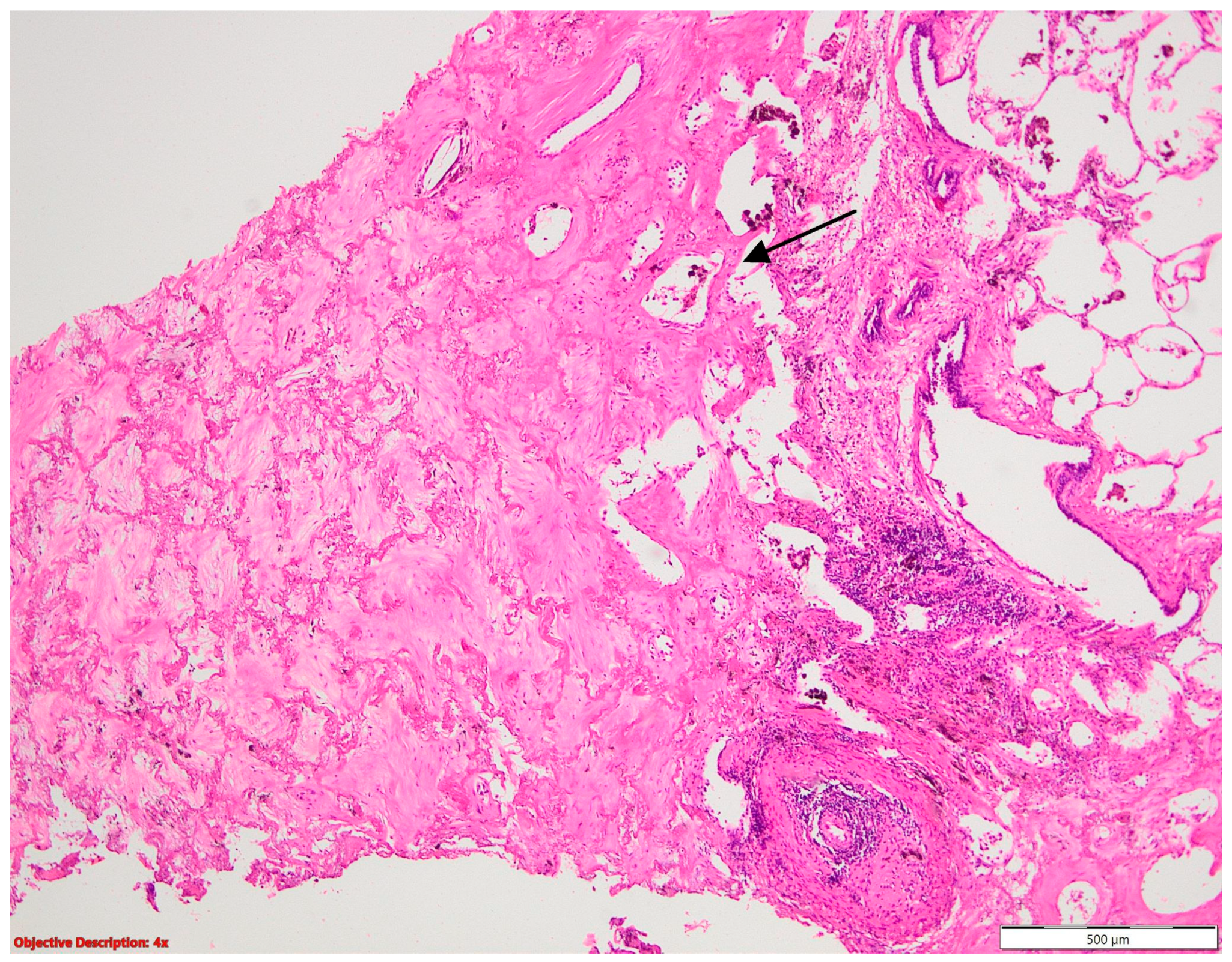 Cancers 16 01903 g012 Cancers 16 01903 g012