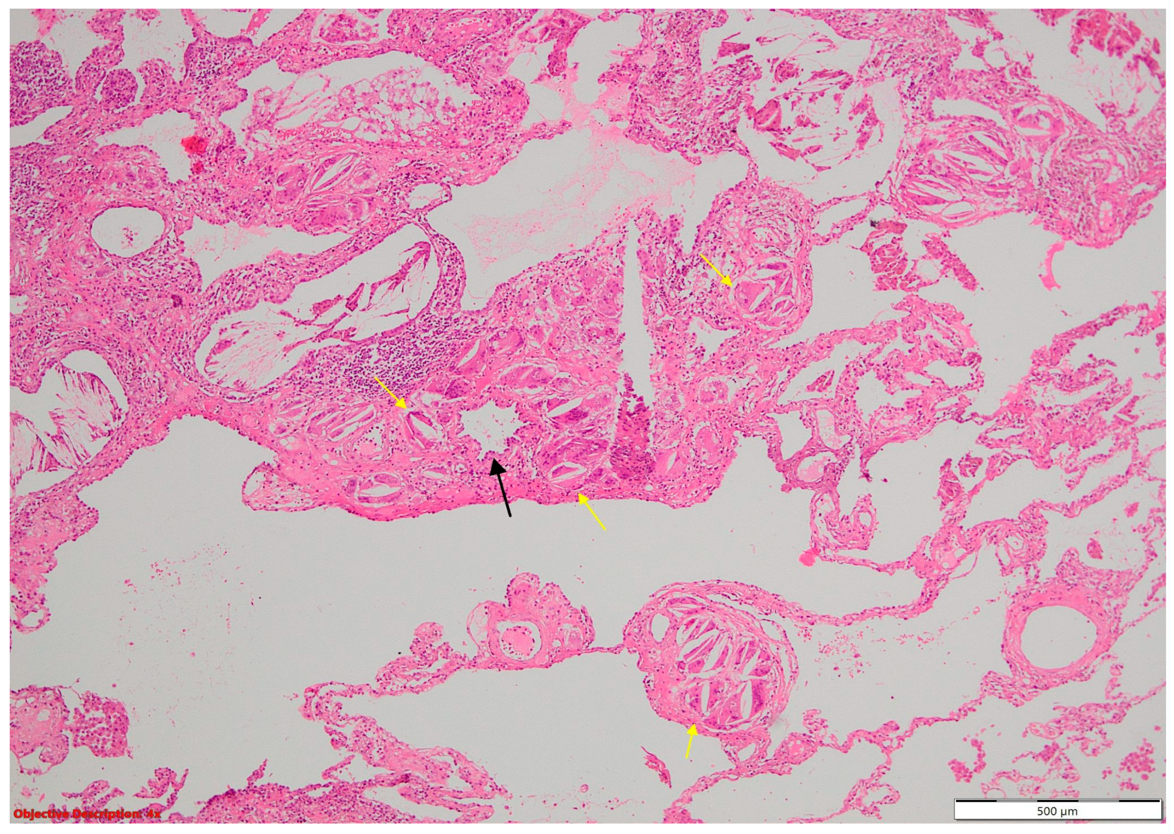 Cancers 16 01903 g013 Cancers 16 01903 g013