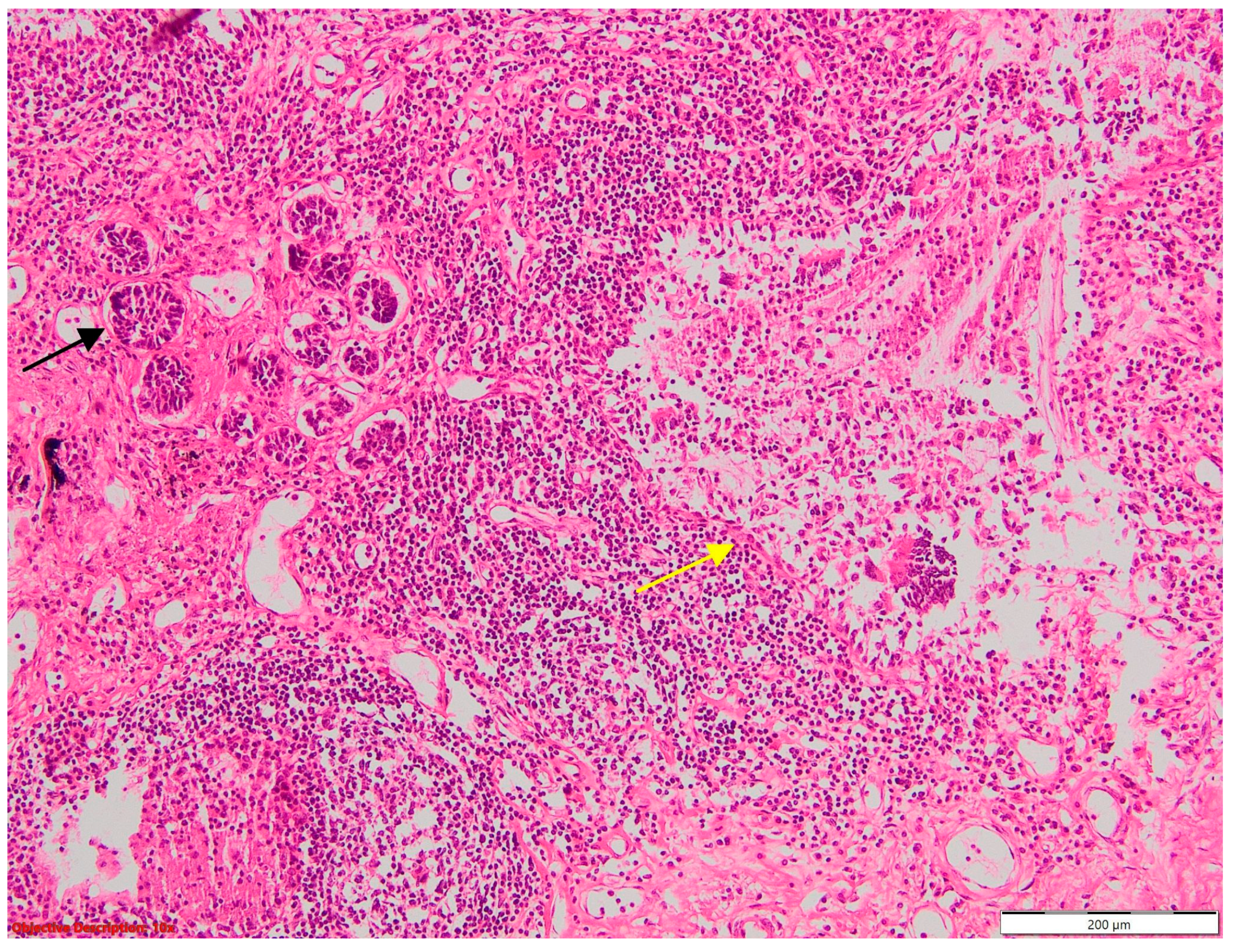 Cancers 16 01903 g014 Cancers 16 01903 g014