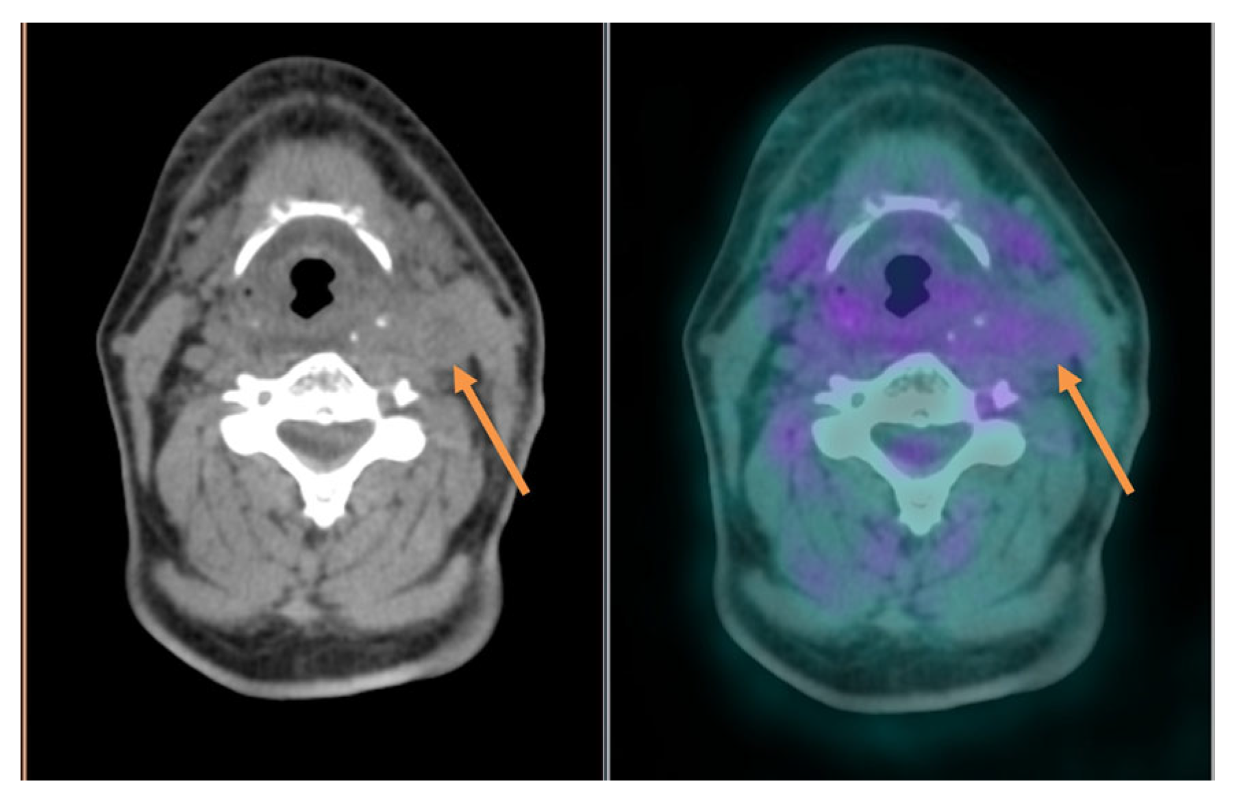 Cancers 16 01905 g004