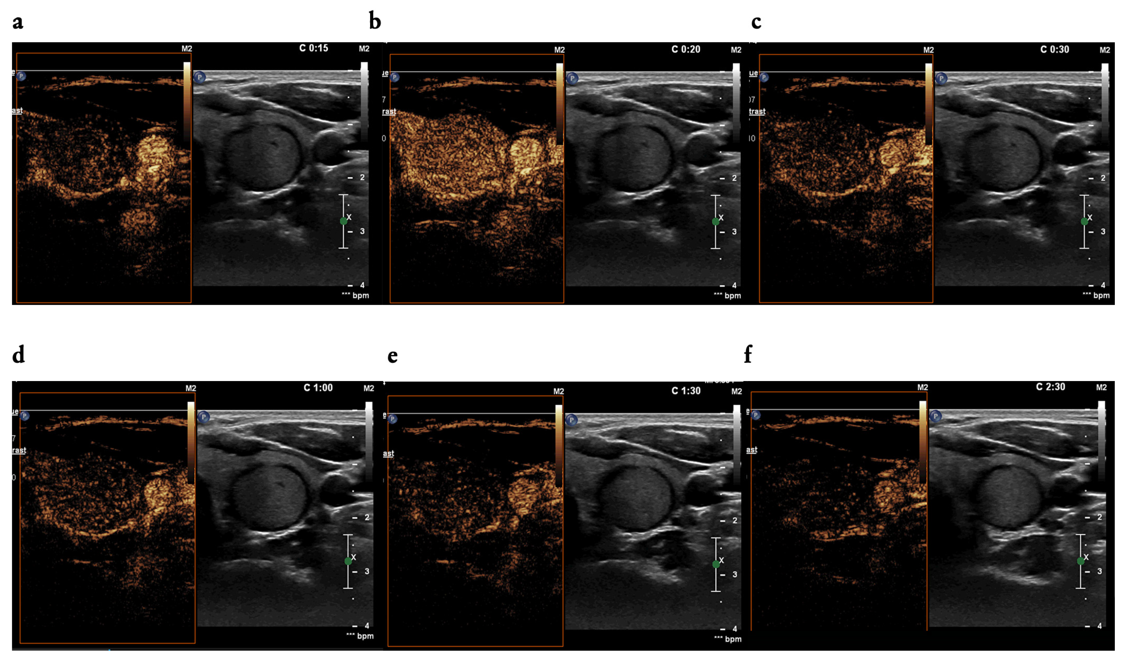 Cancers 16 01911 g001