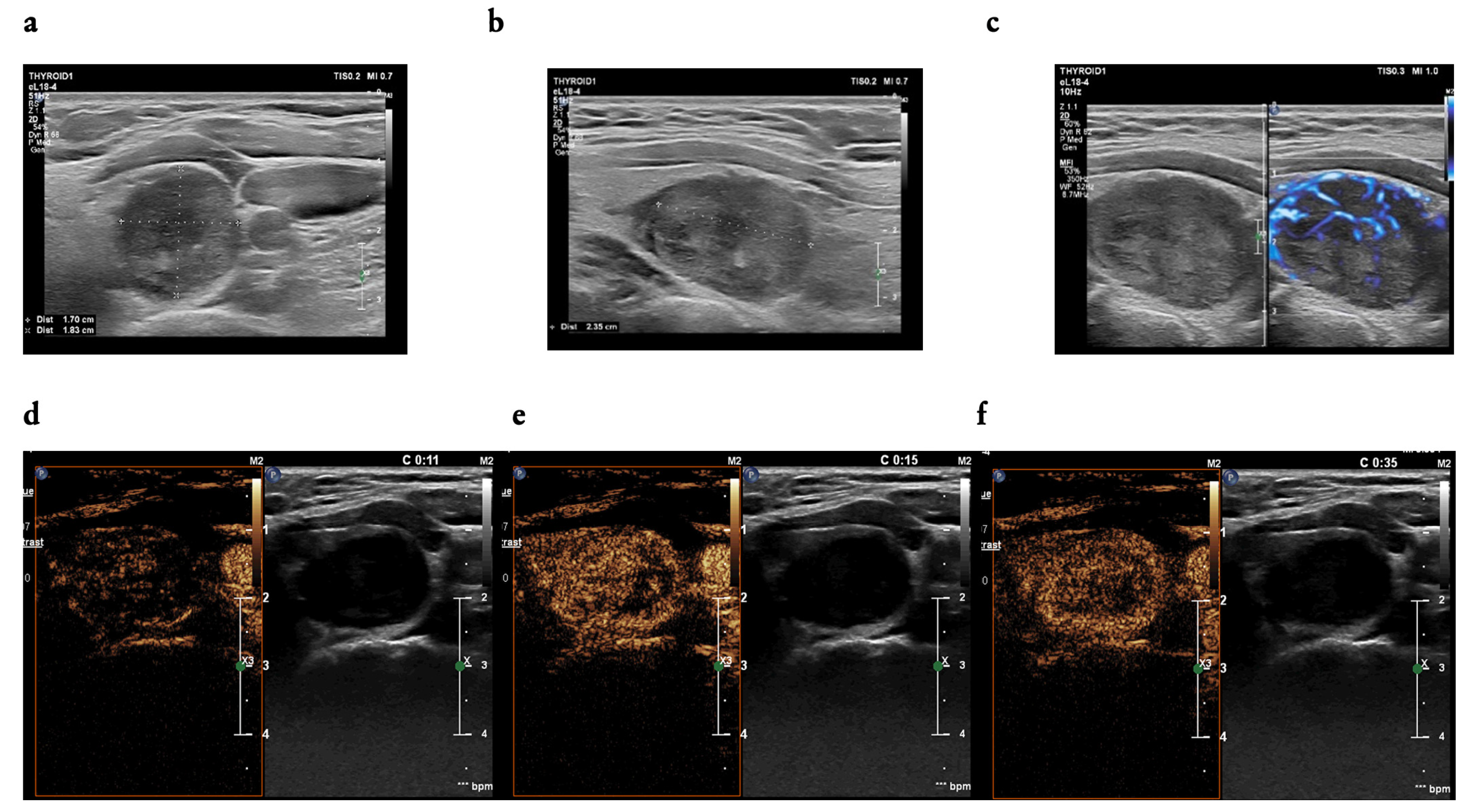 Cancers 16 01911 g002