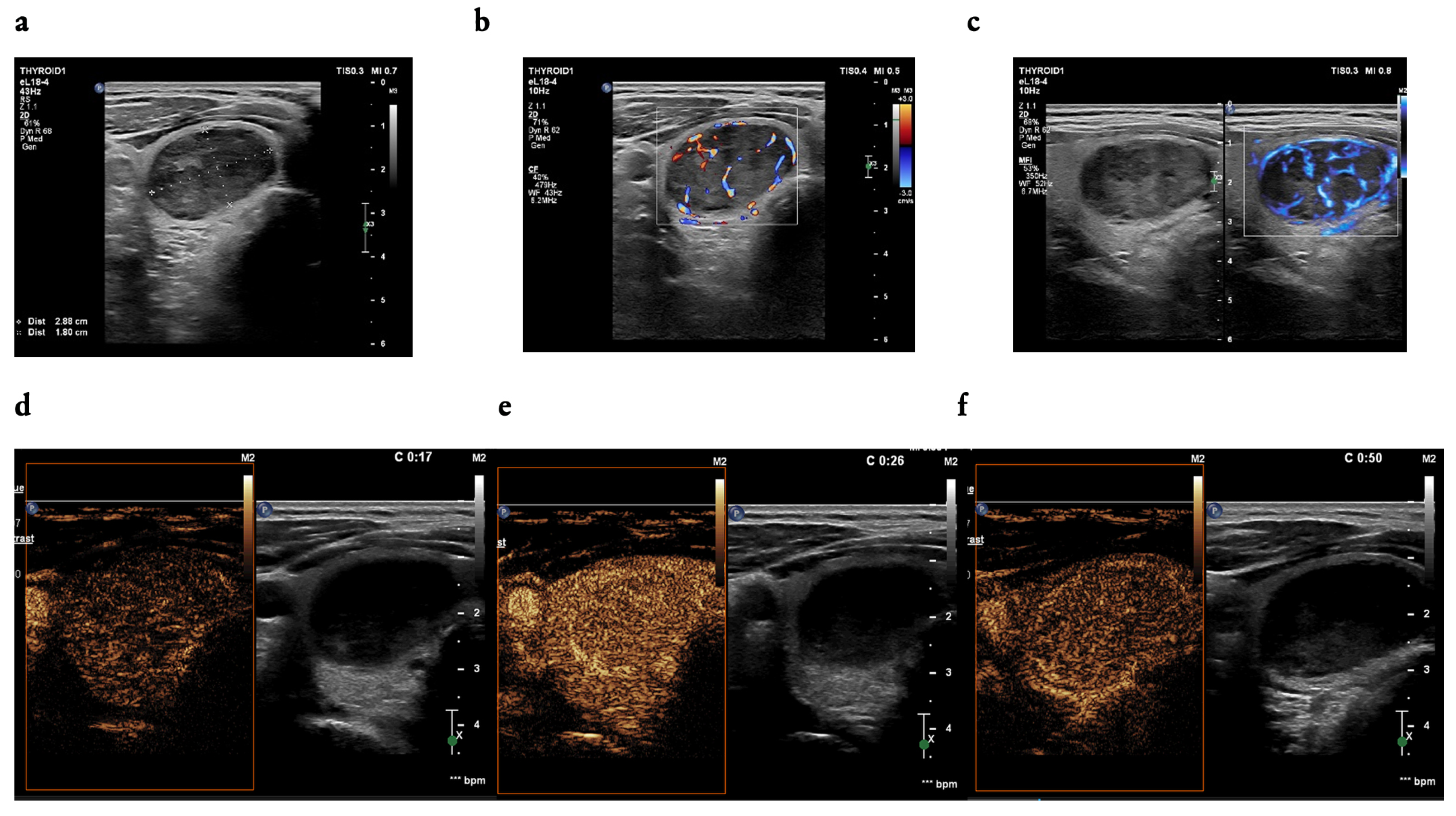 Cancers 16 01911 g003