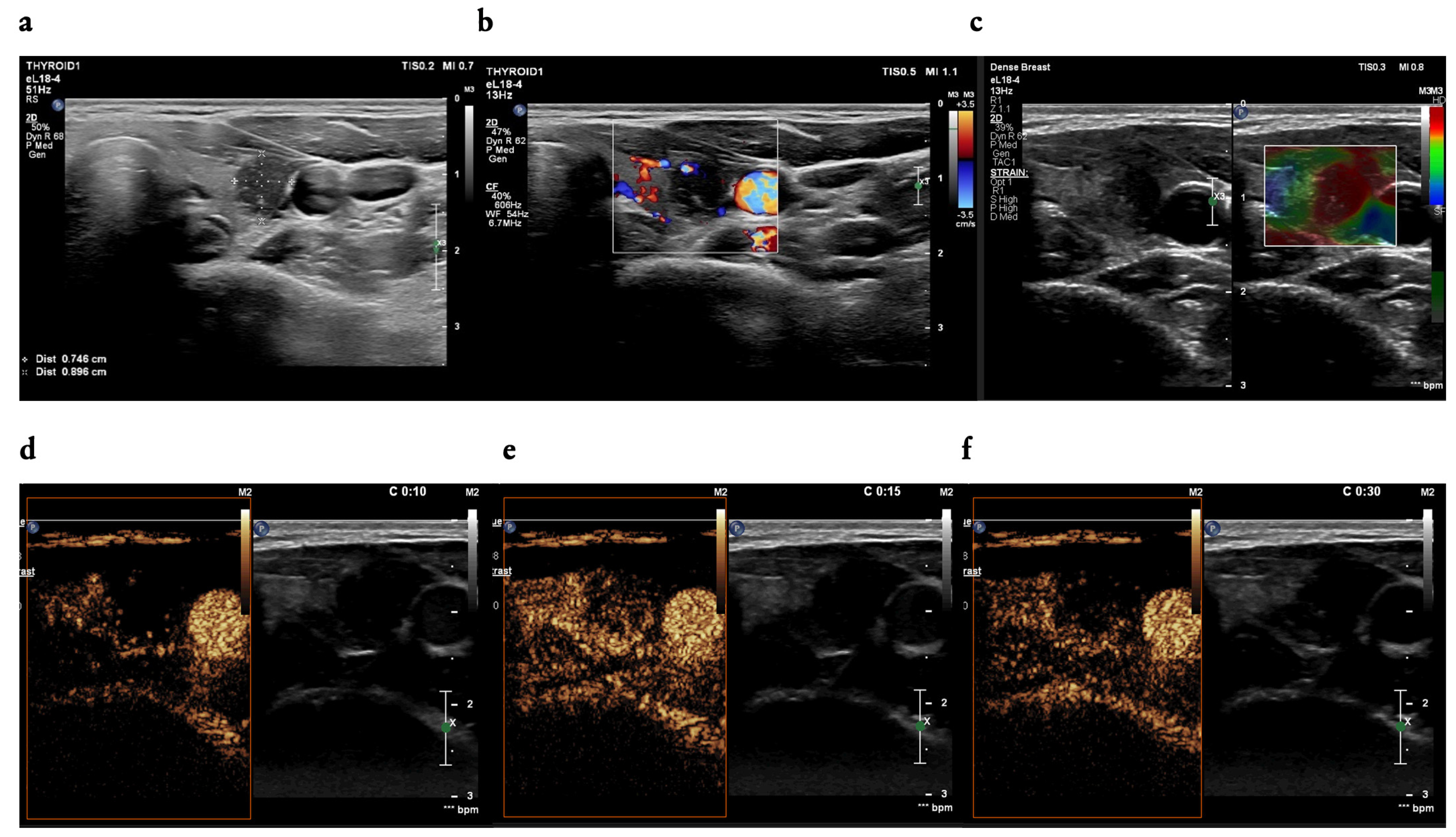 Cancers 16 01911 g004
