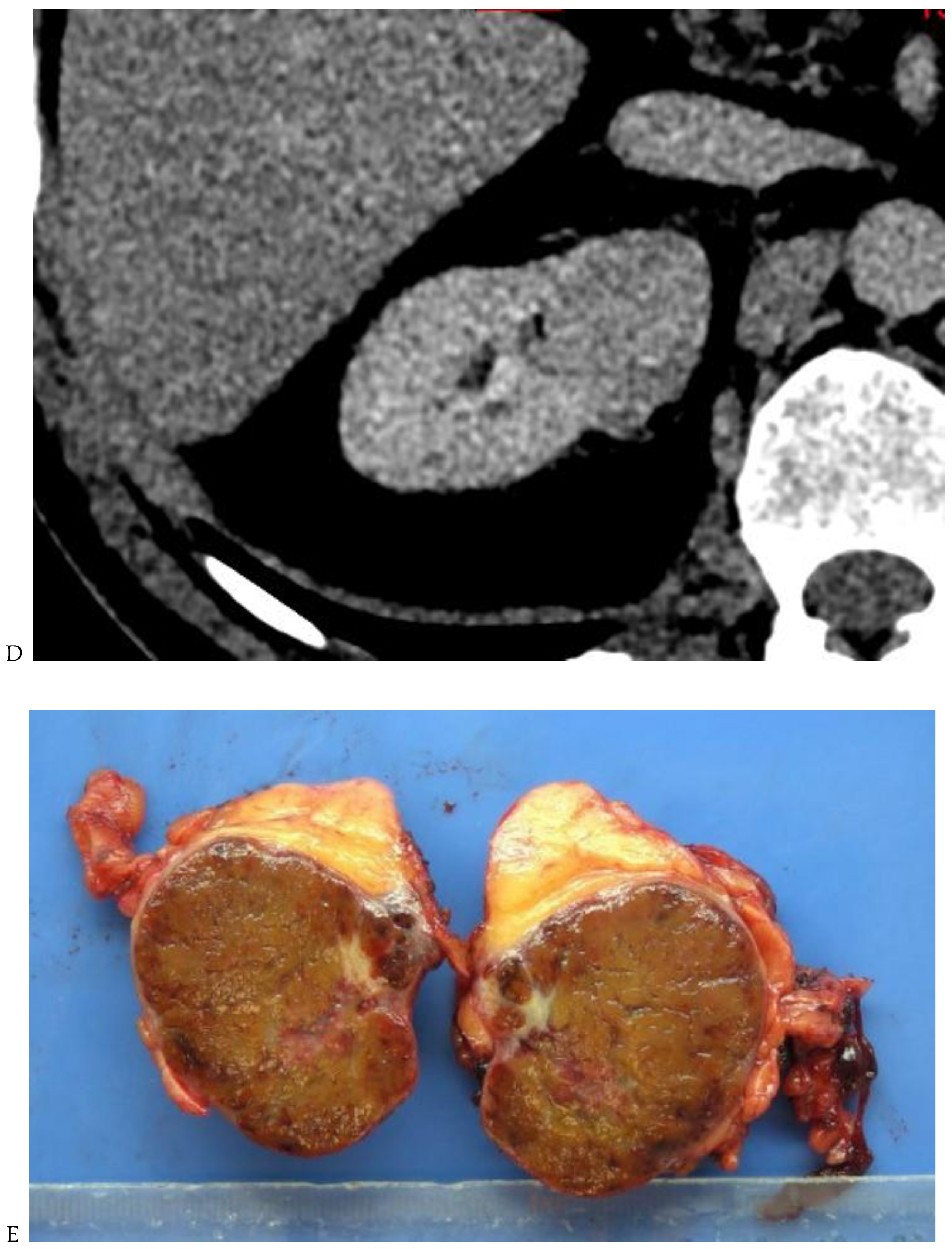 Cancers 16 01926 g002c