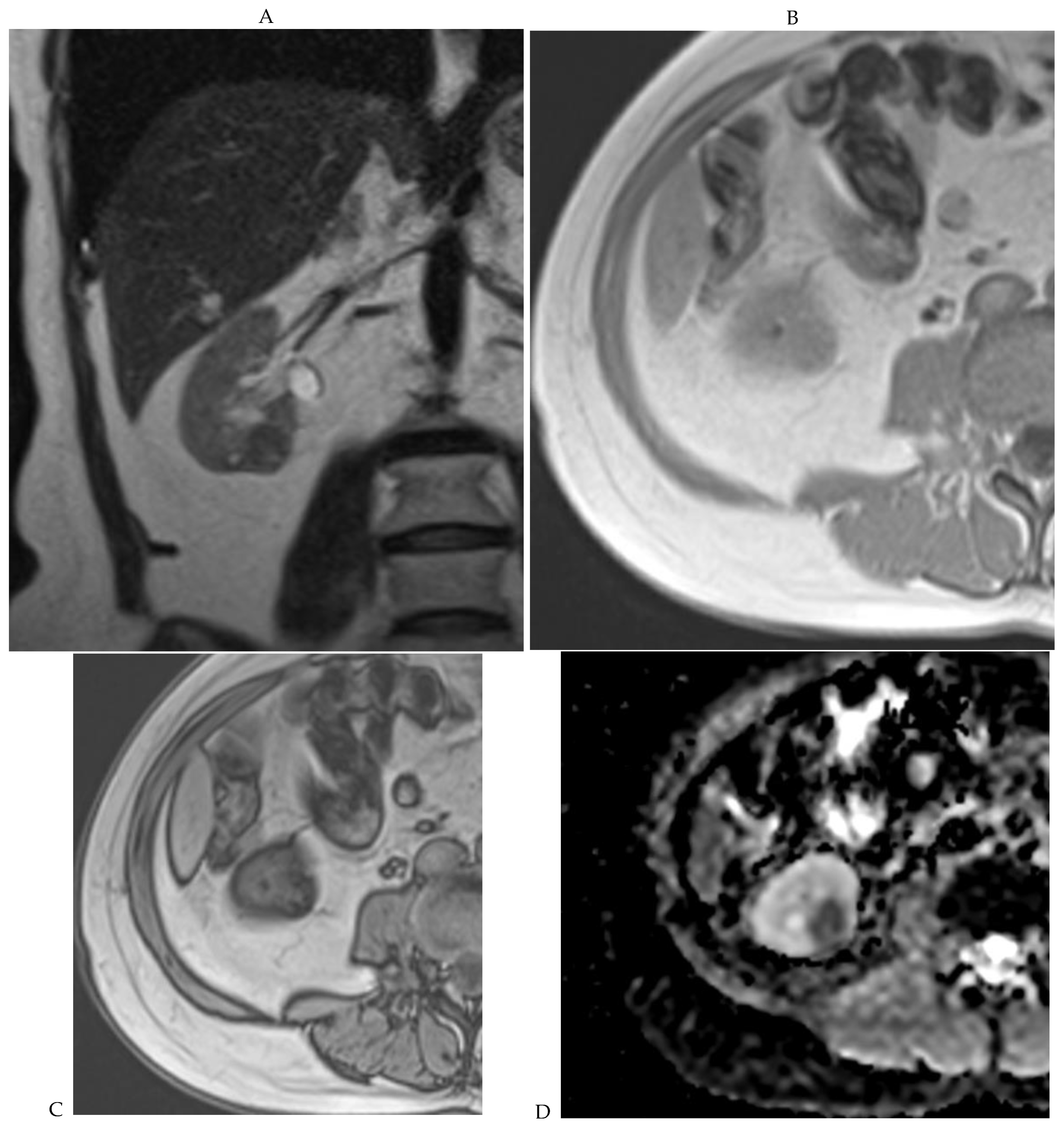 Cancers 16 01926 g006a