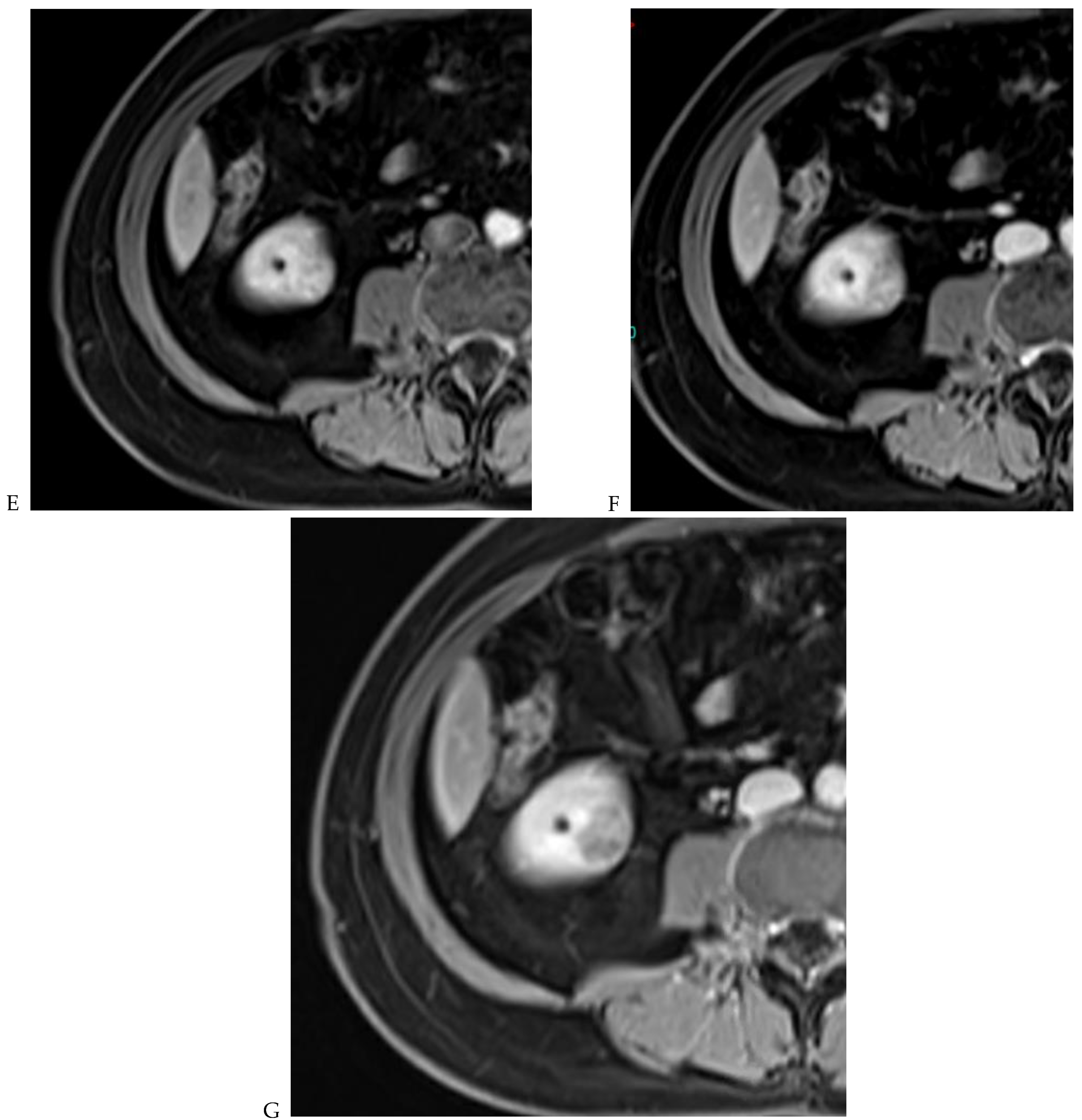 Cancers 16 01926 g006b