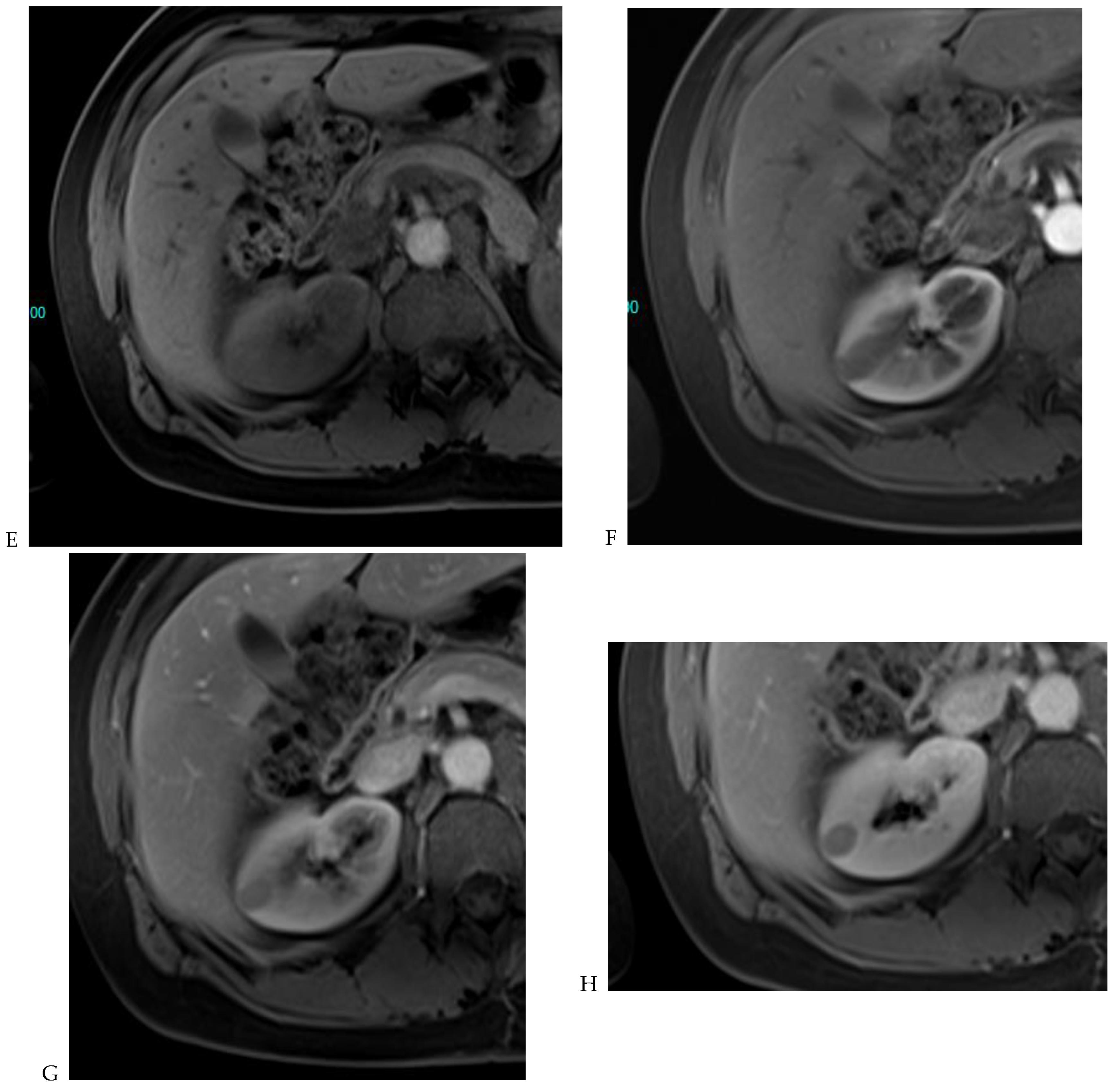 Cancers 16 01926 g007b