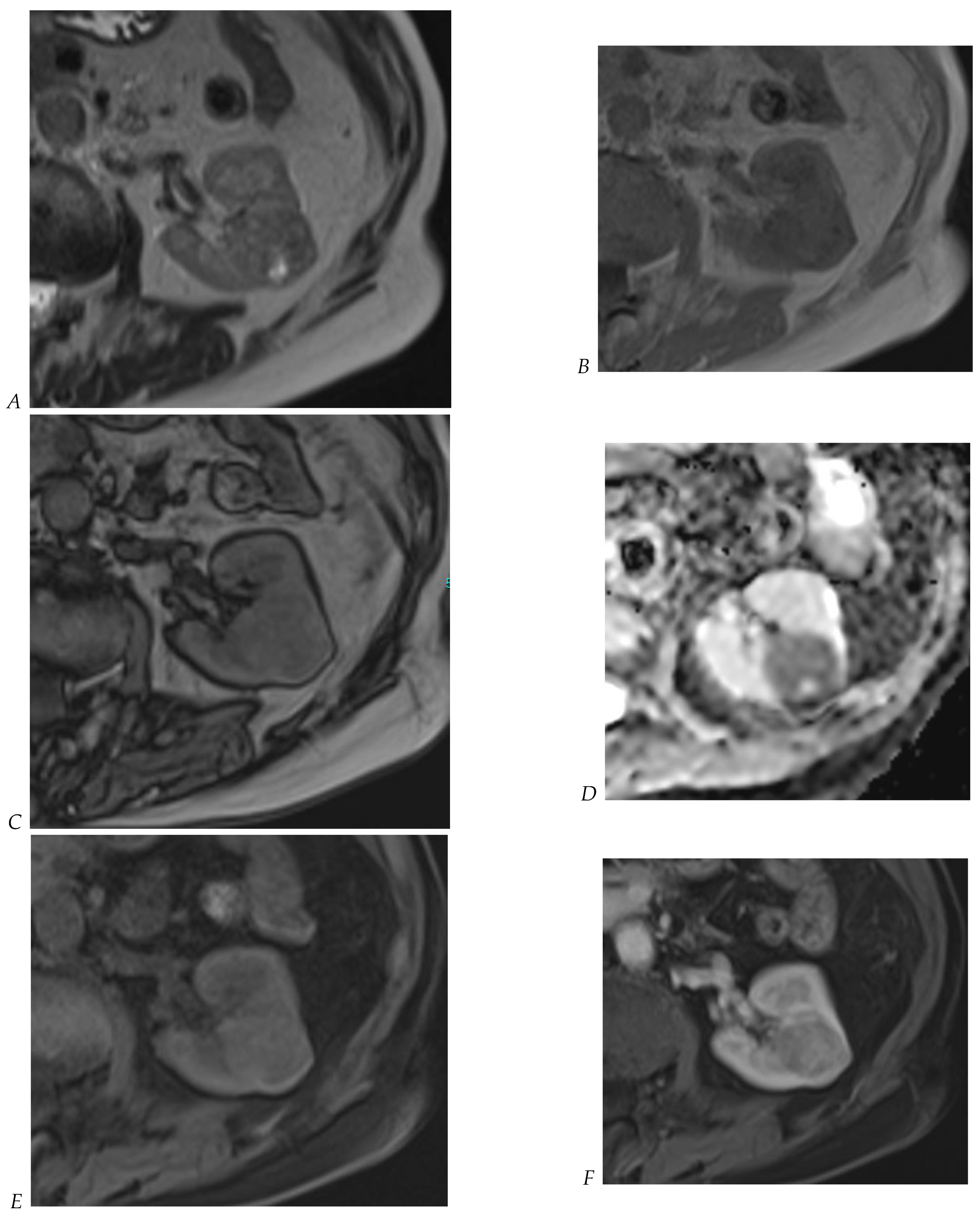 Cancers 16 01926 g008a