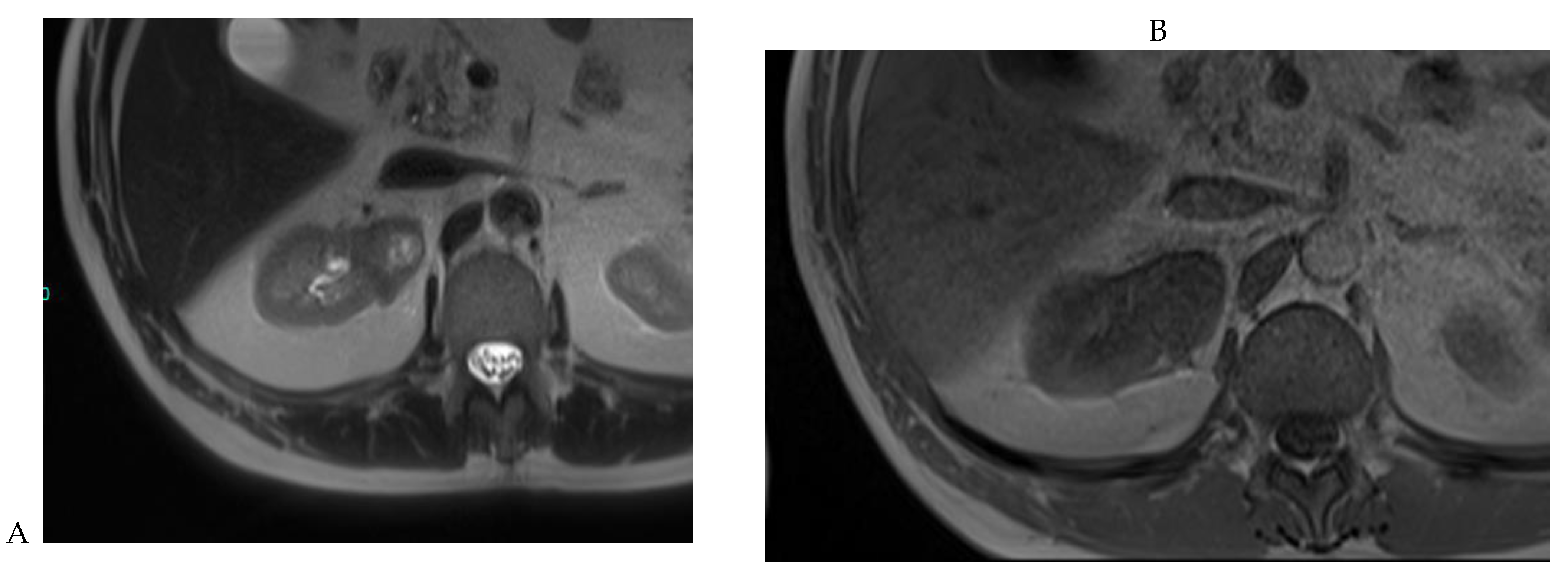 Cancers 16 01926 g009a