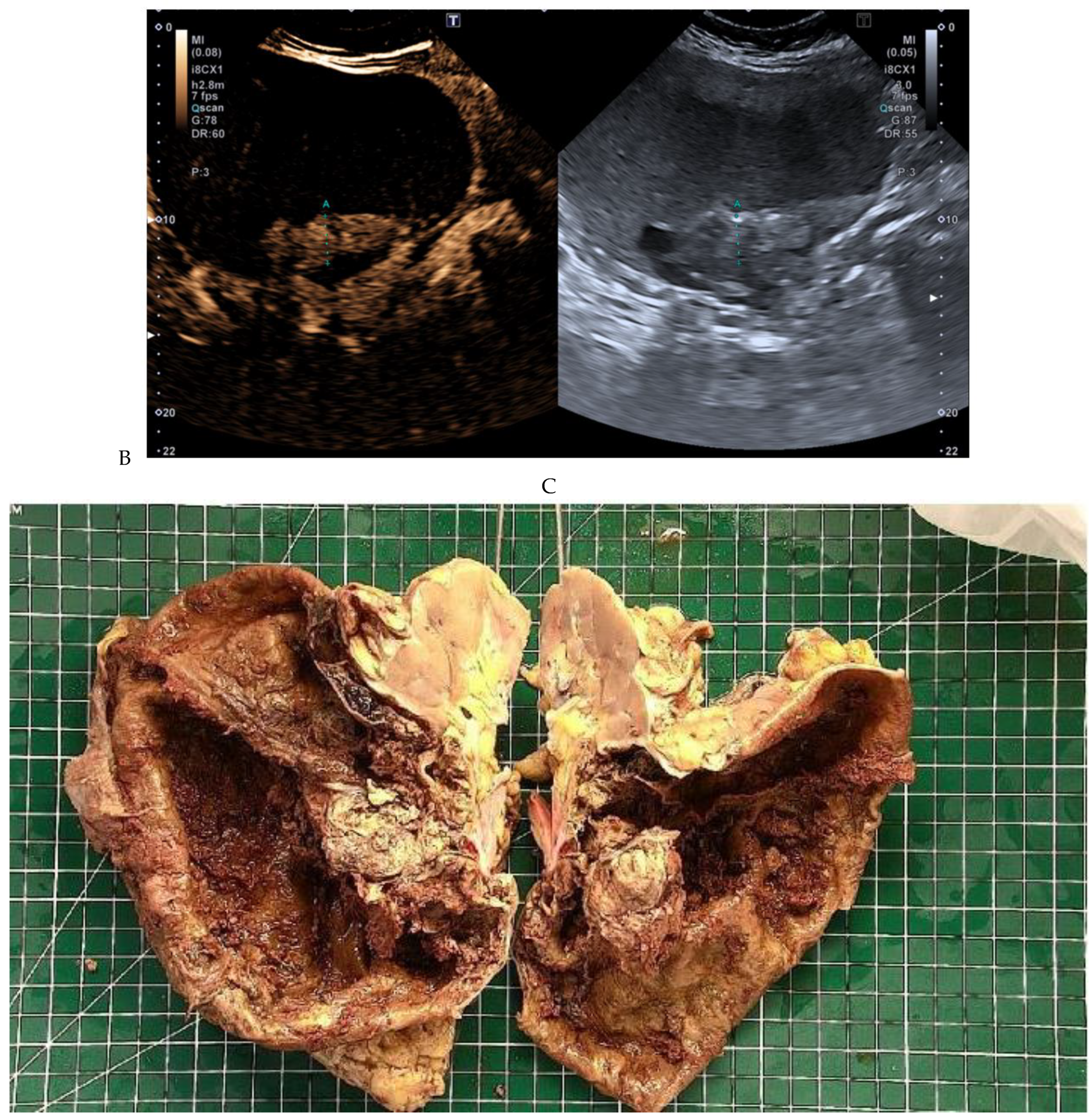 Cancers 16 01926 g010b