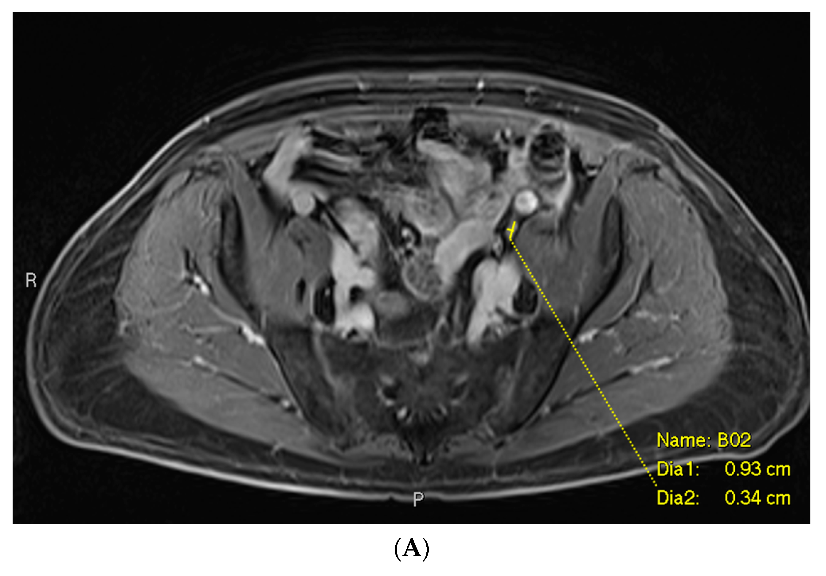 Cancers 16 02056 g003a
