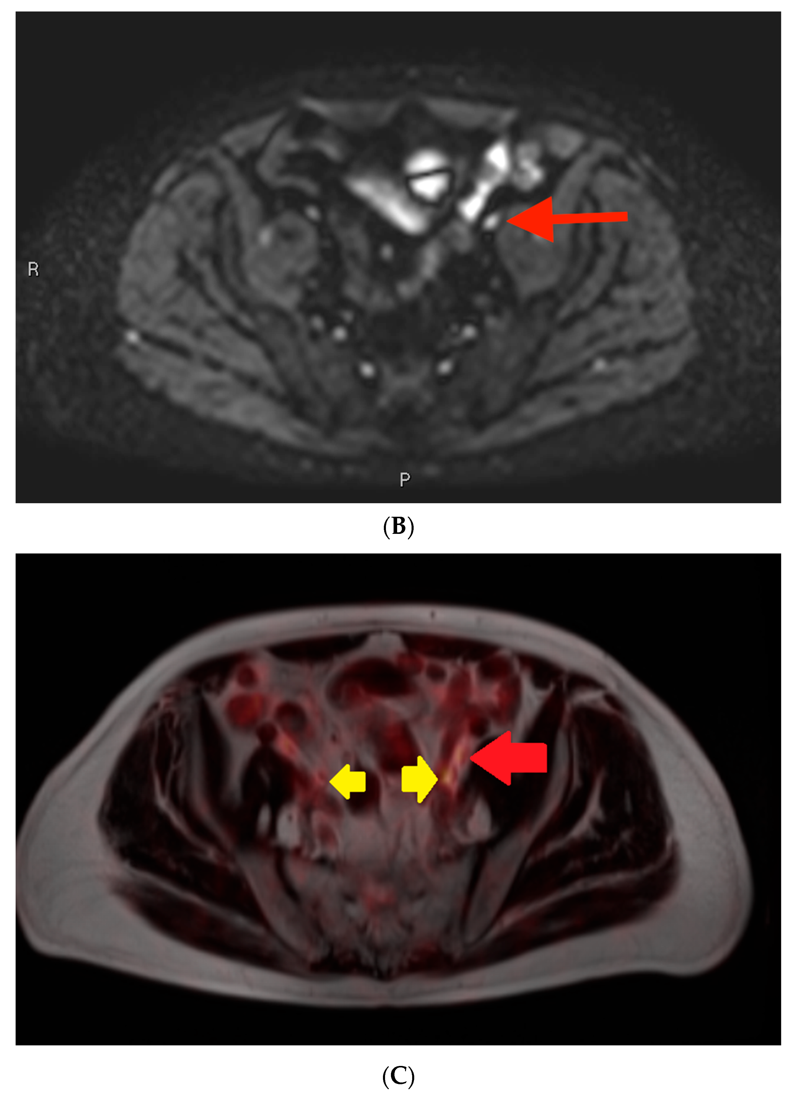 Cancers 16 02056 g003b