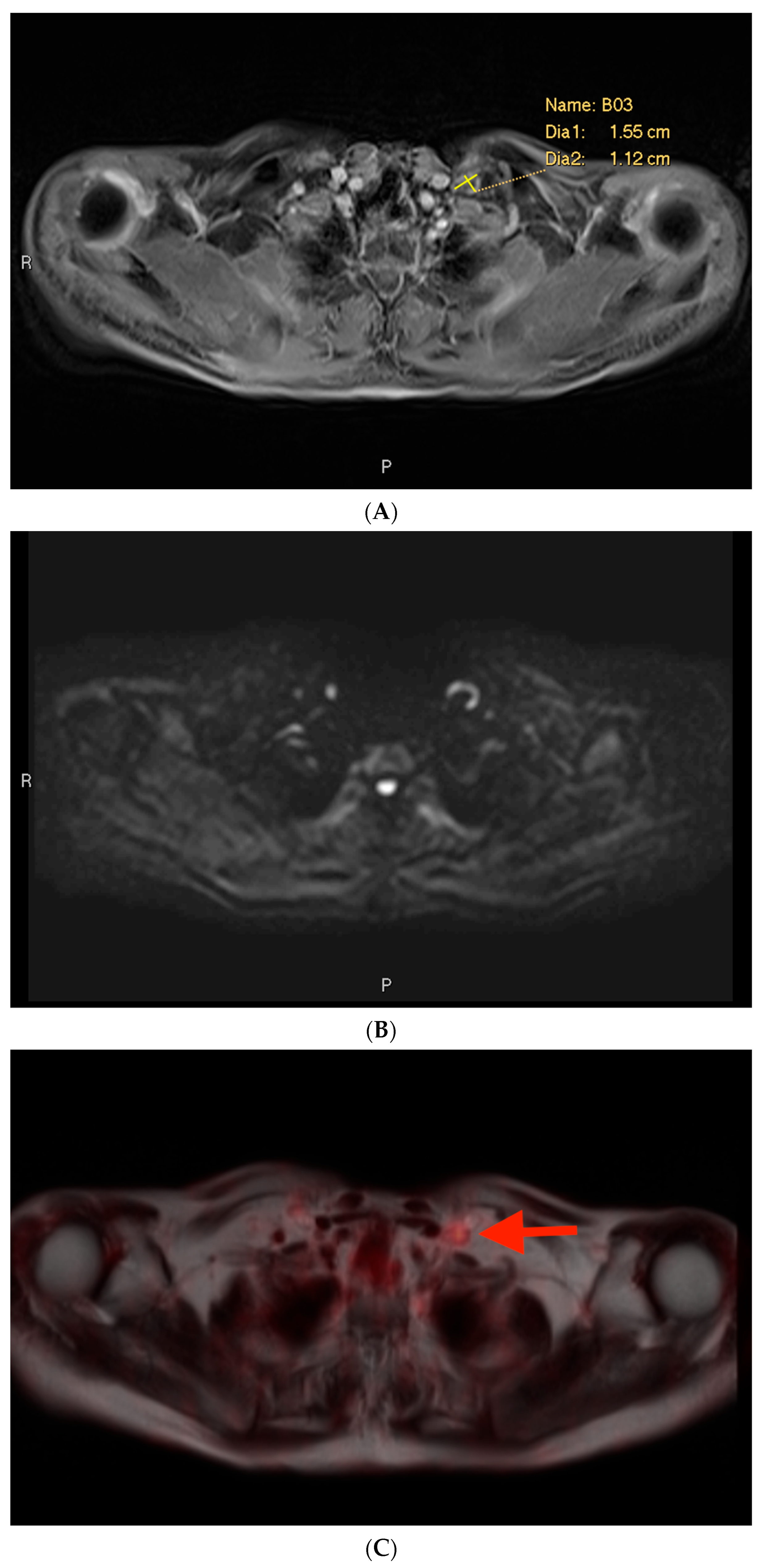 Cancers 16 02056 g004