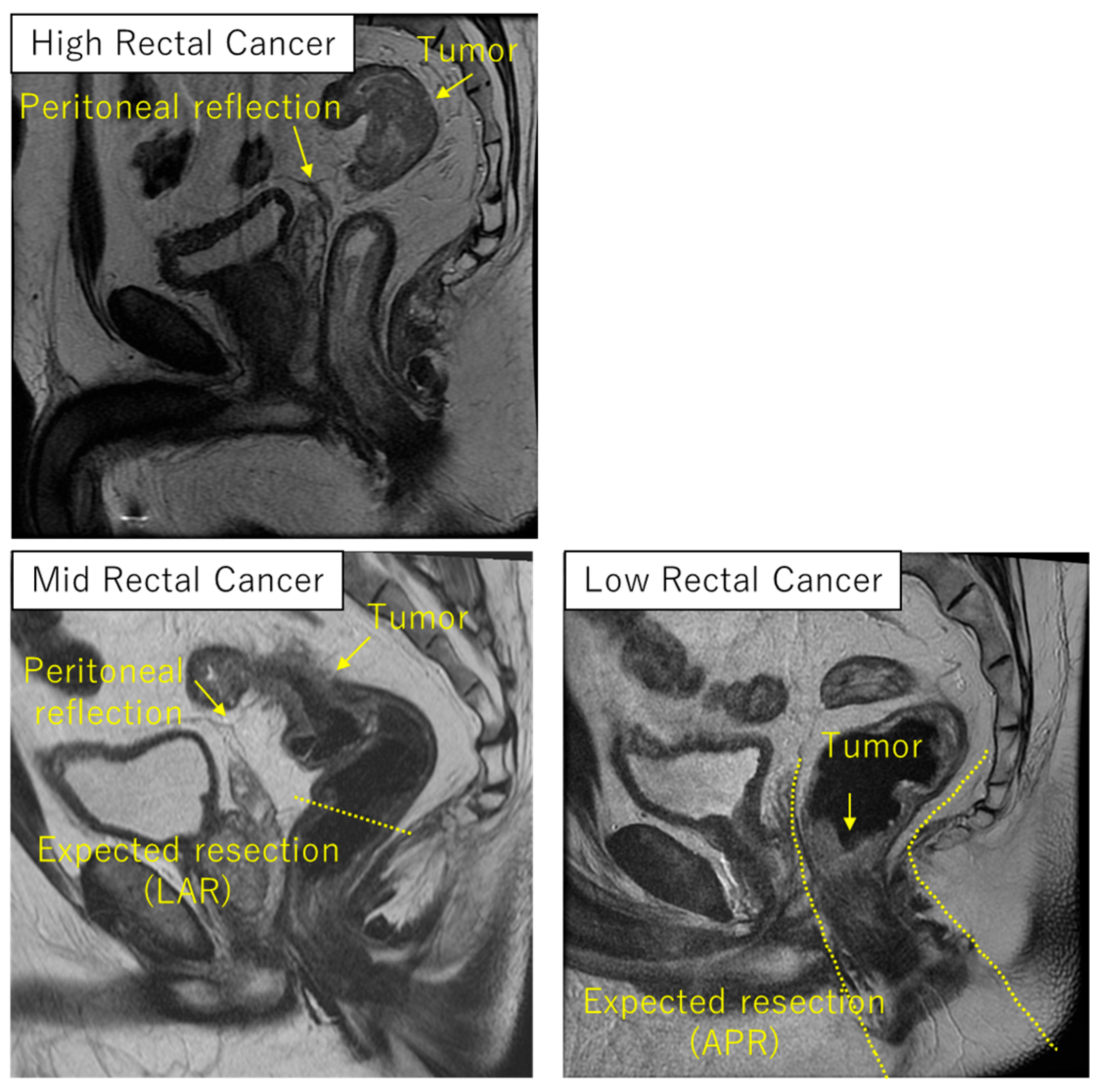 Cancers 16 02093 g002