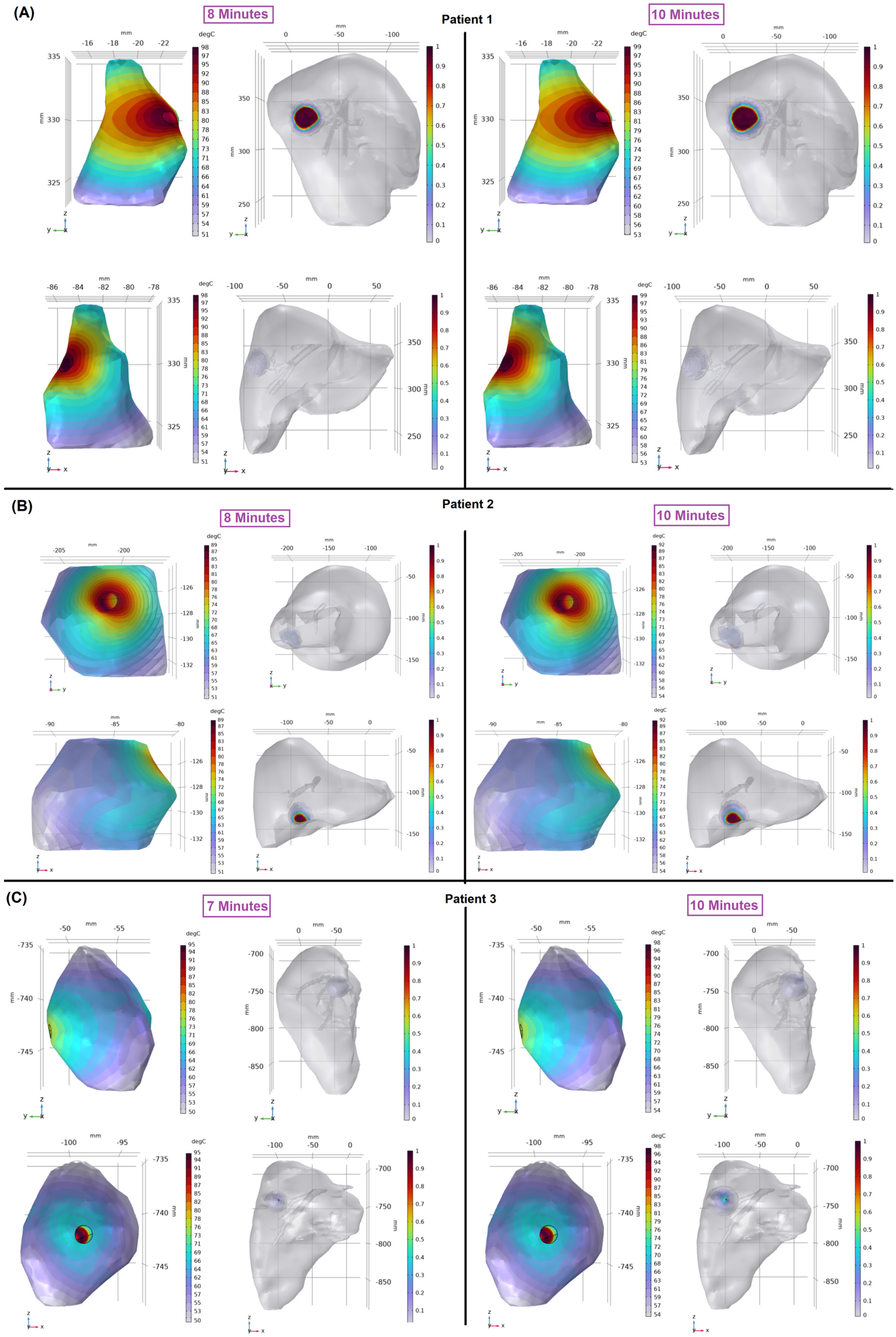 Cancers 16 02095 g004