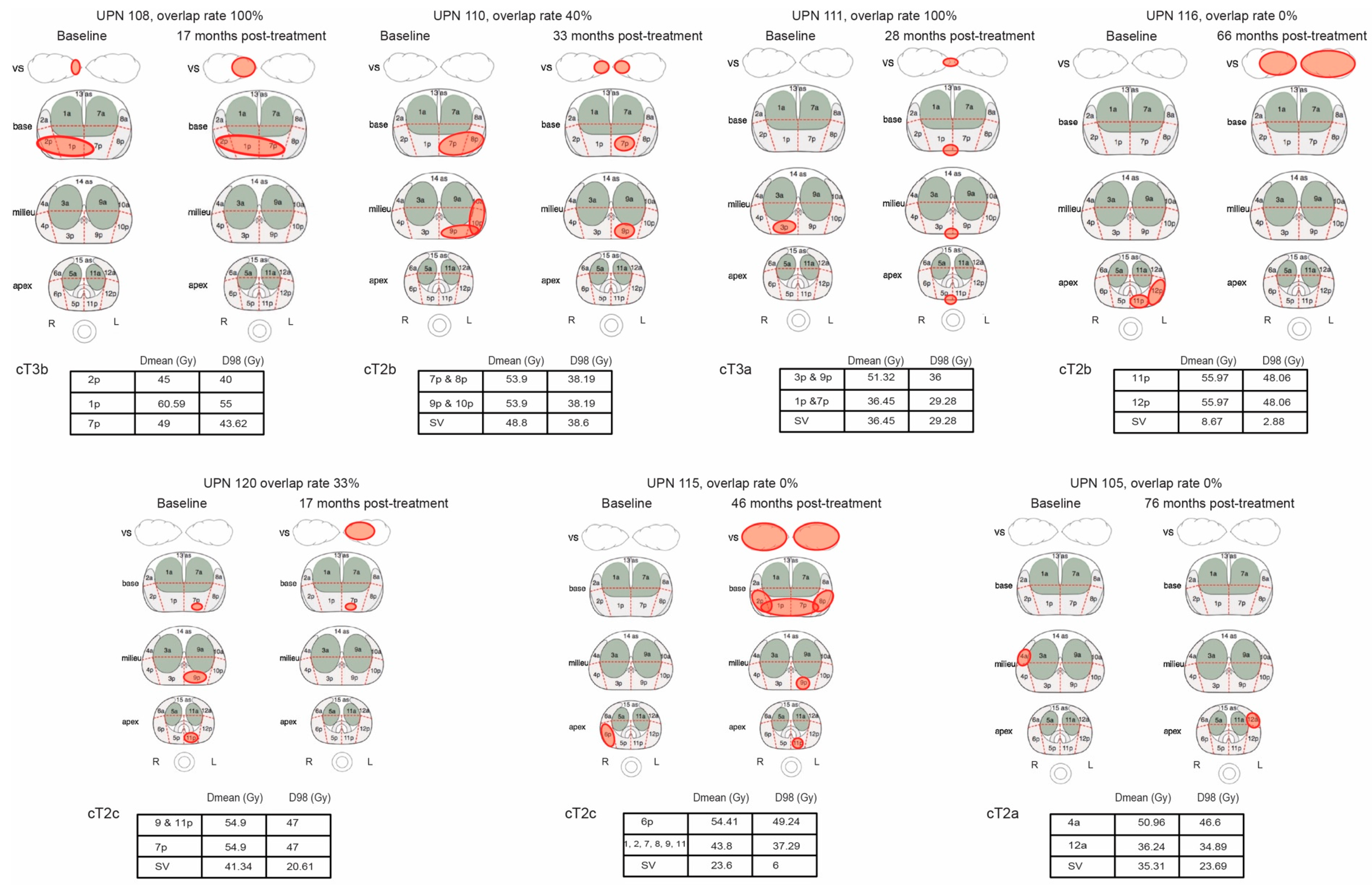 Cancers 16 02097 g001