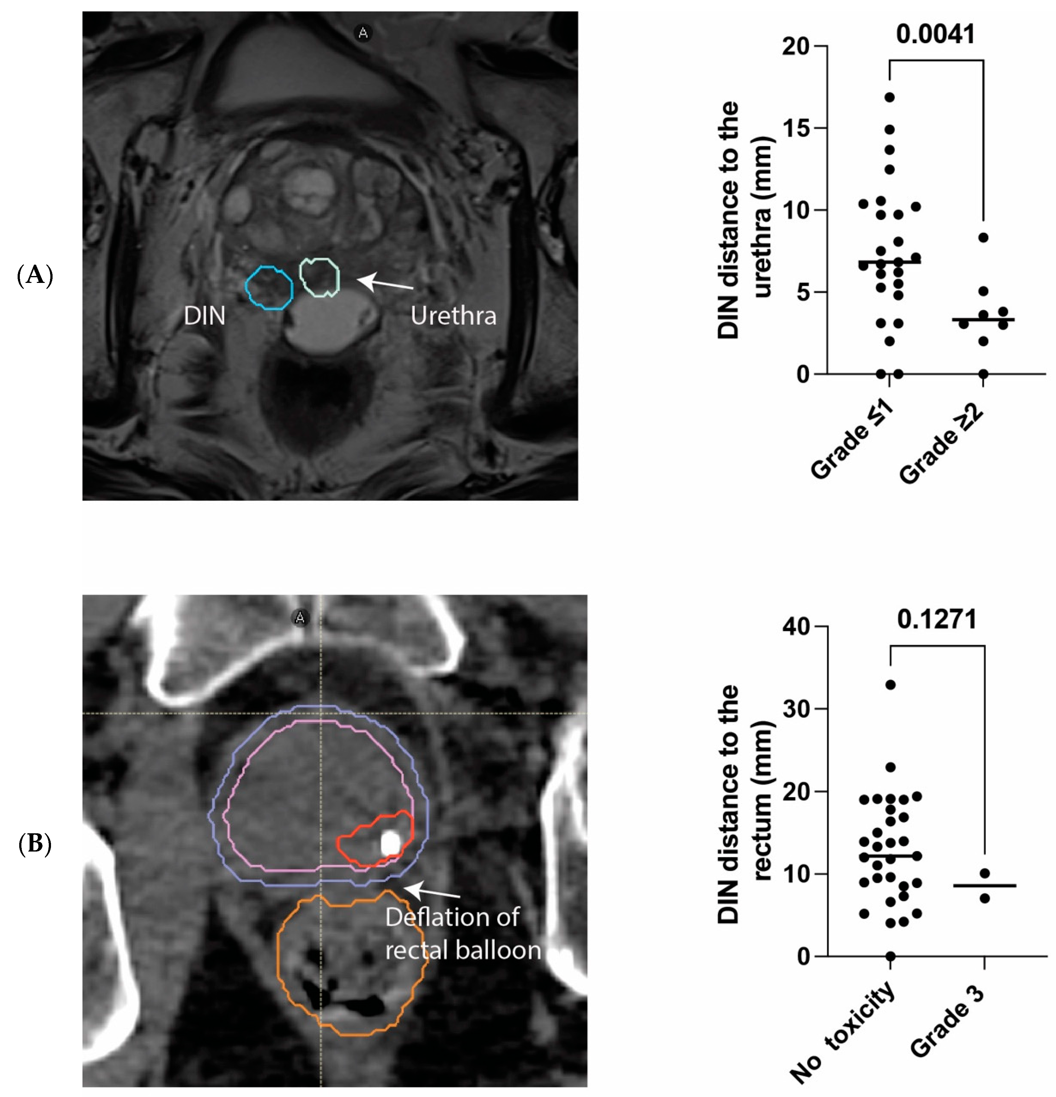 Cancers 16 02097 g003