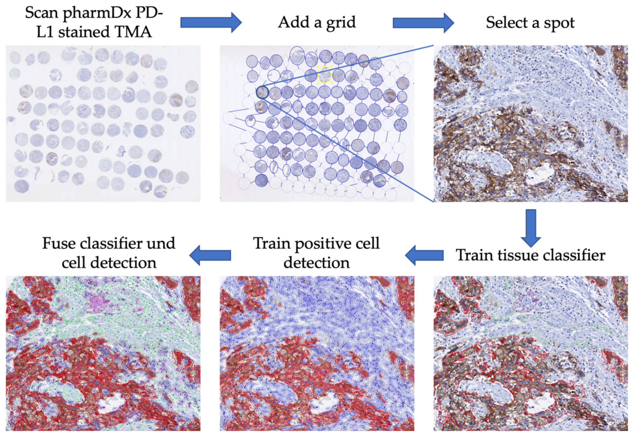 Cancers 16 02103 g002