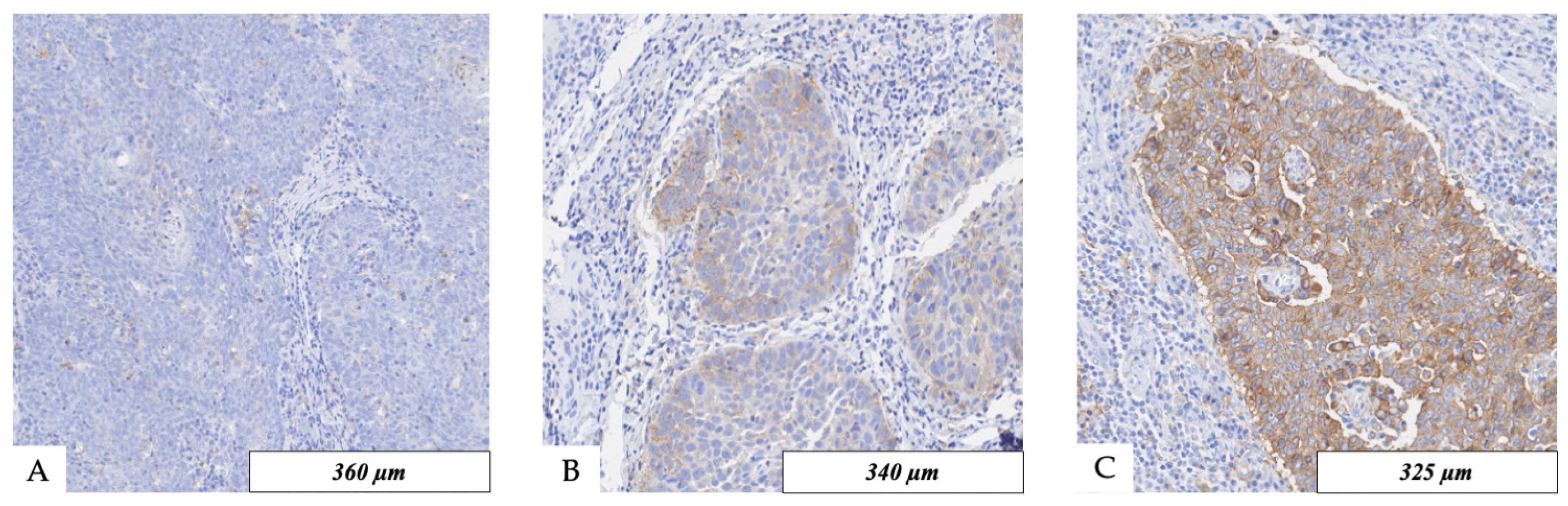 Cancers 16 02103 g003