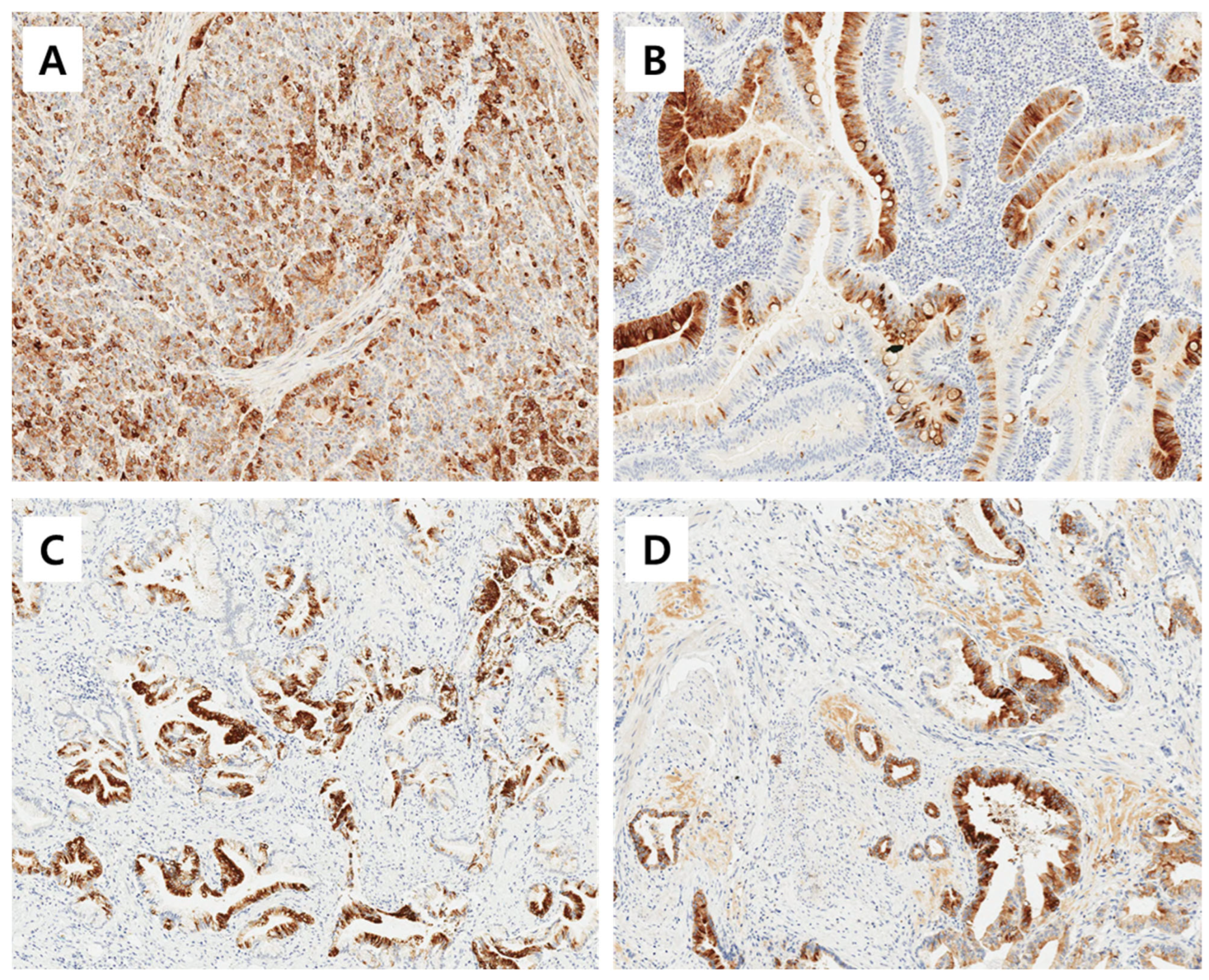 Cancers 16 02120 g001