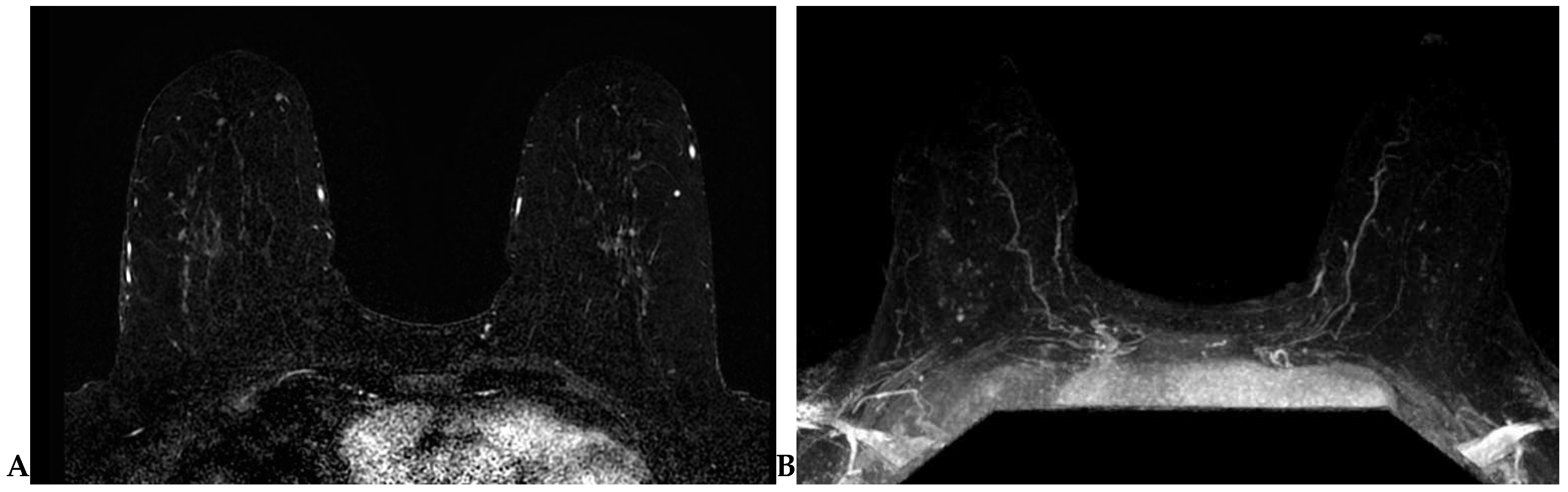 Cancers 16 02122 g002