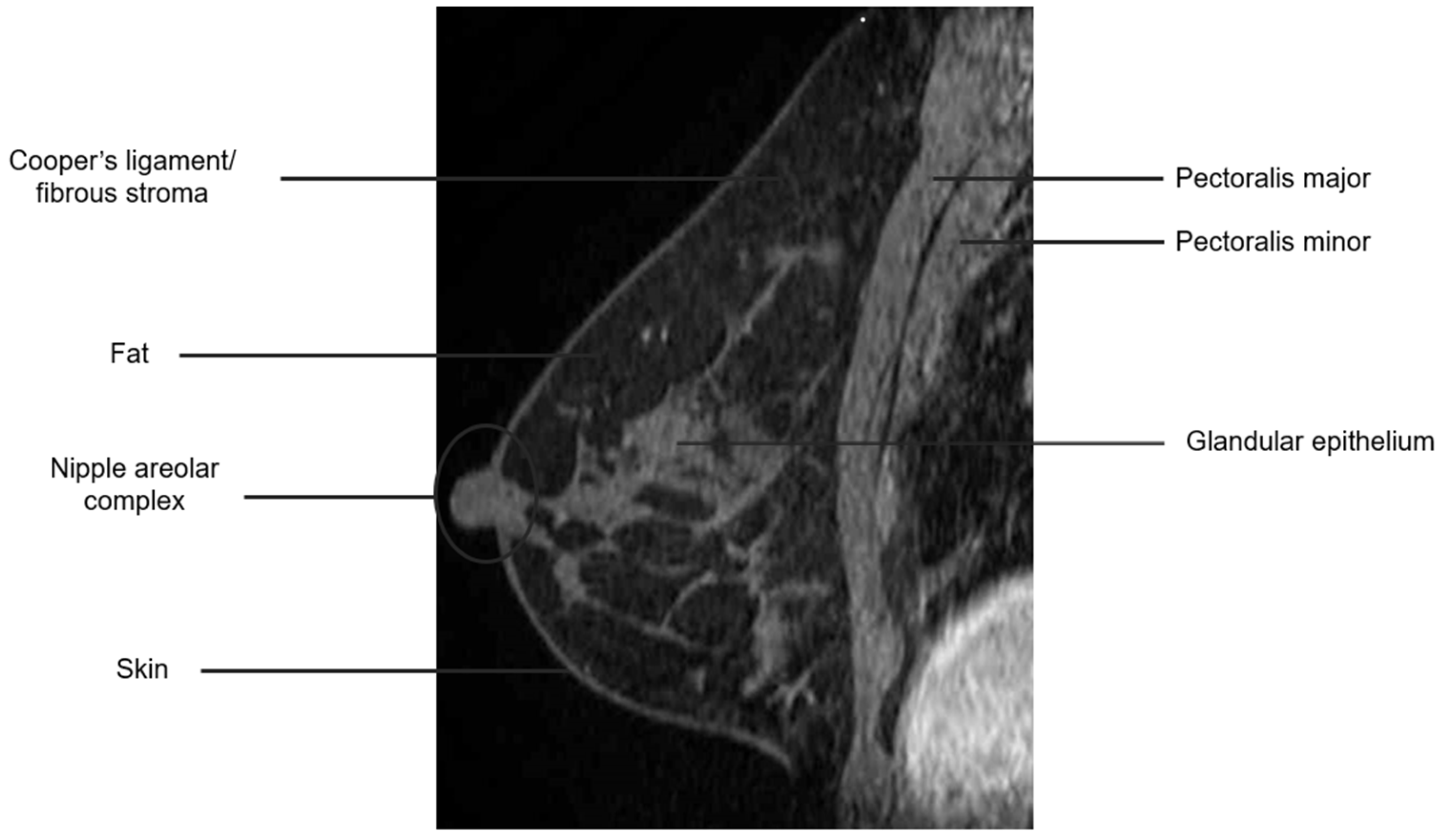 Cancers 16 02122 g003