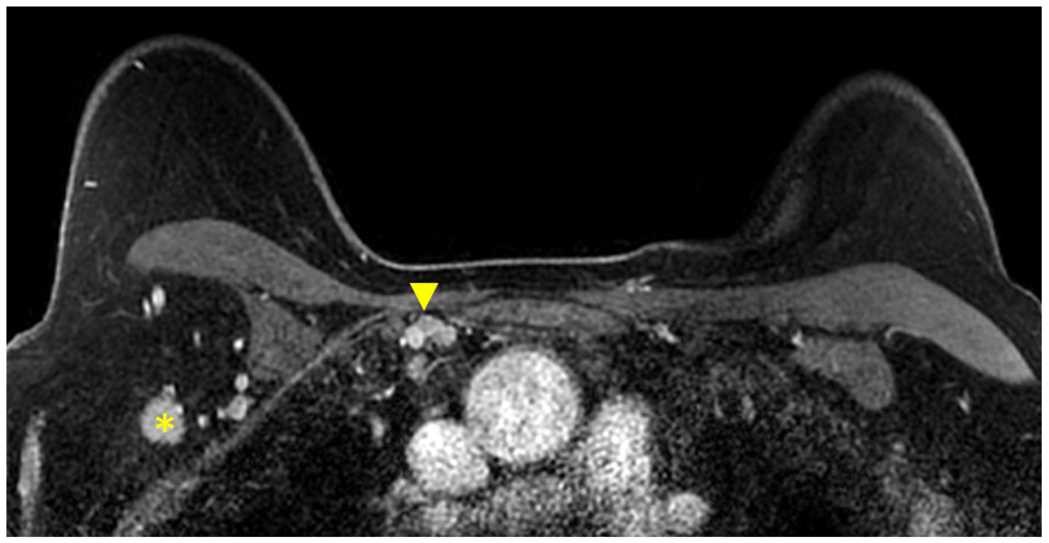 Cancers 16 02122 g006