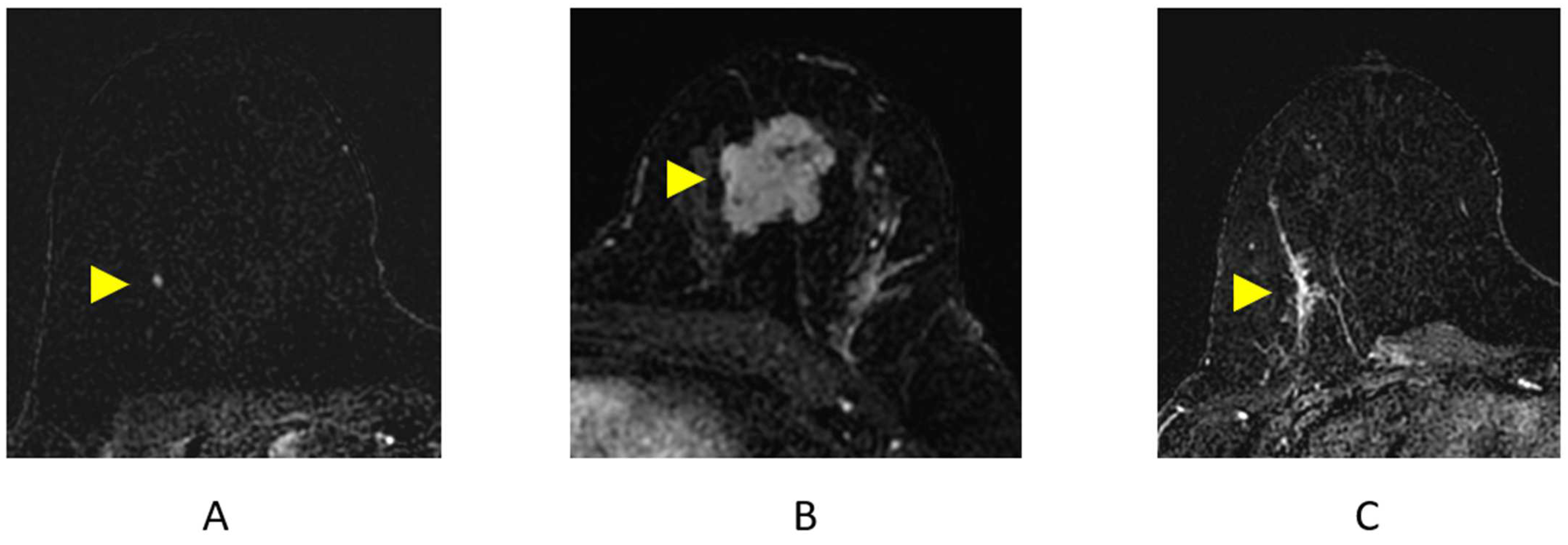 Cancers 16 02122 g007