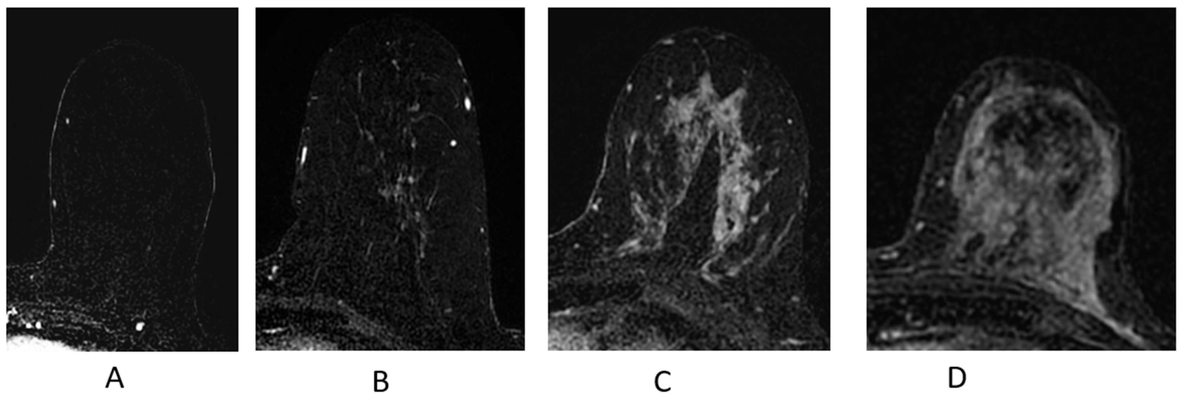 Cancers 16 02122 g008