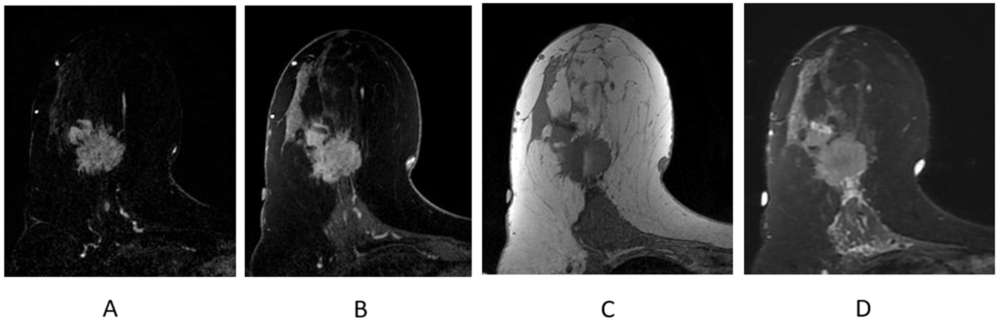 Cancers 16 02122 g009