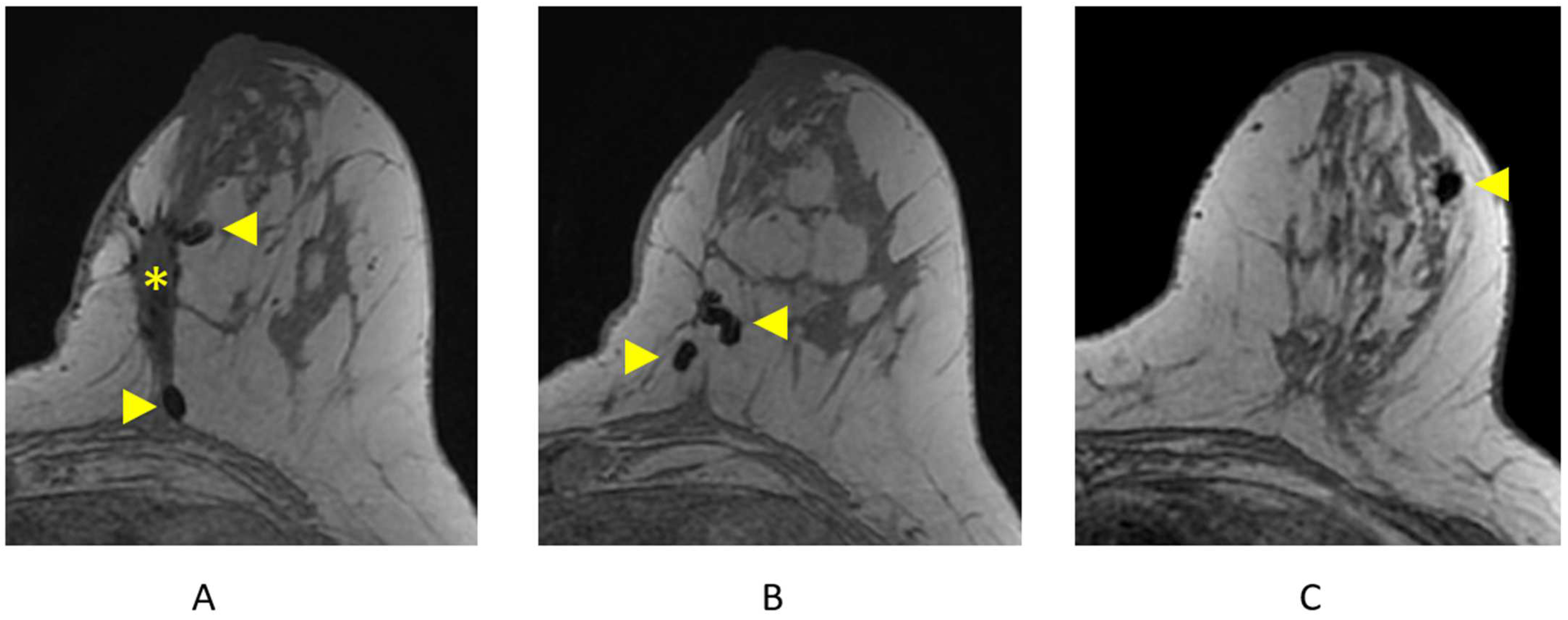 Cancers 16 02122 g012