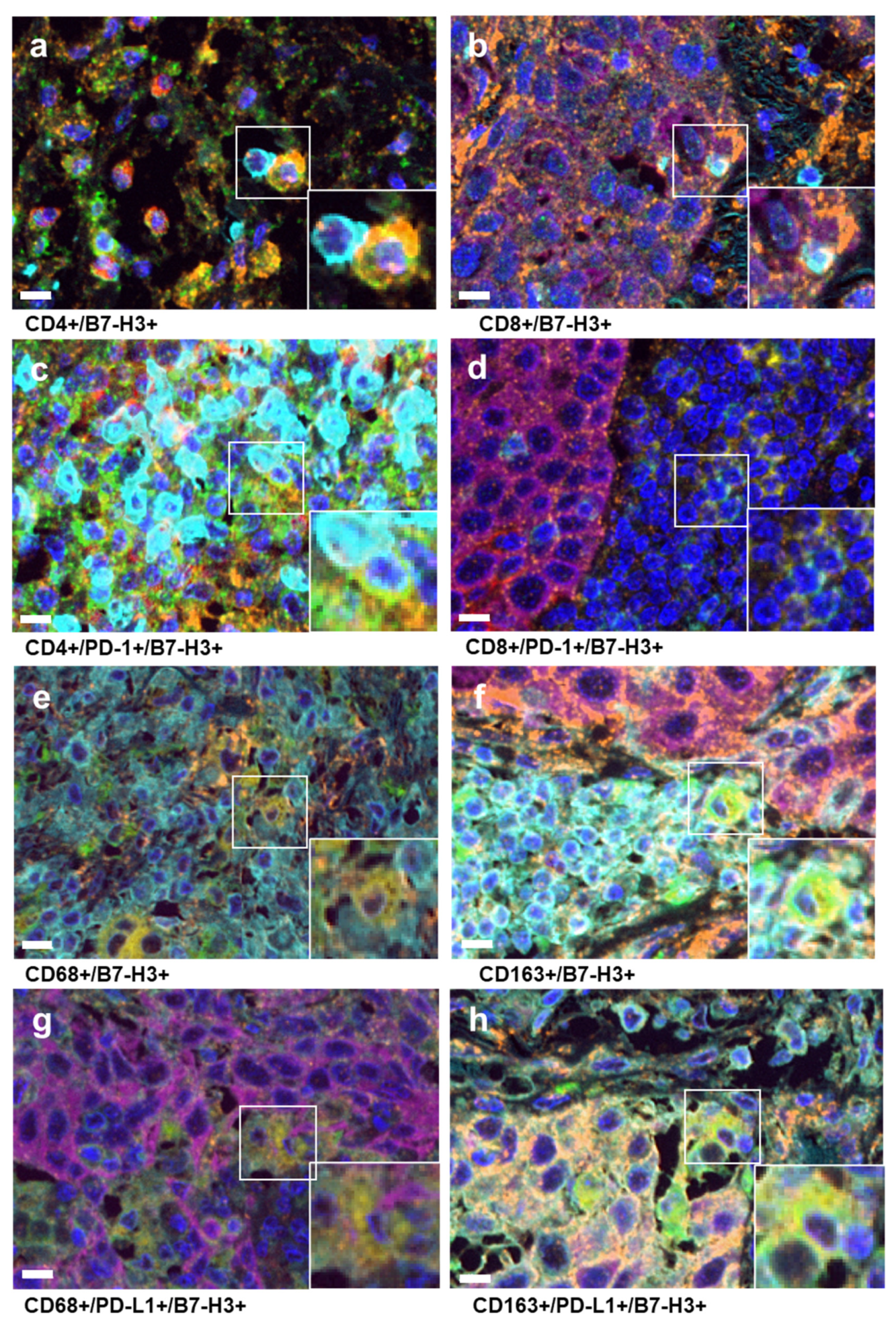 Cancers 16 02140 g001