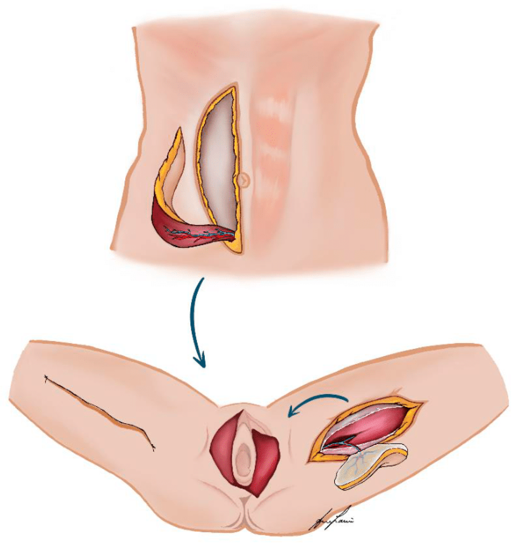 Cancers 16 02213 g001