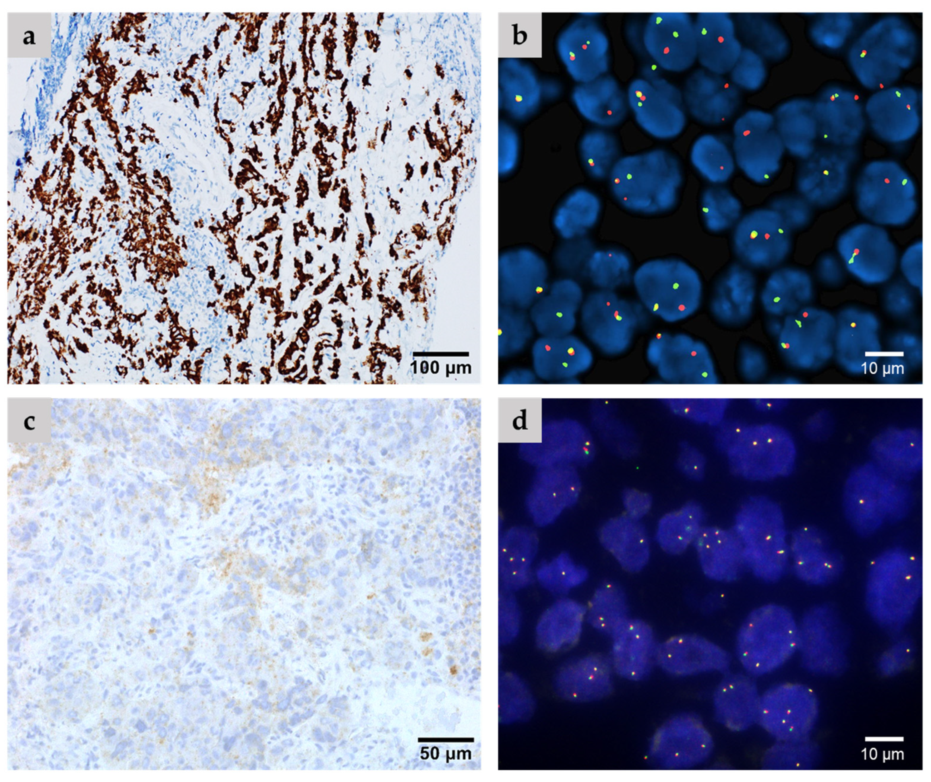 Cancers 16 02219 g002