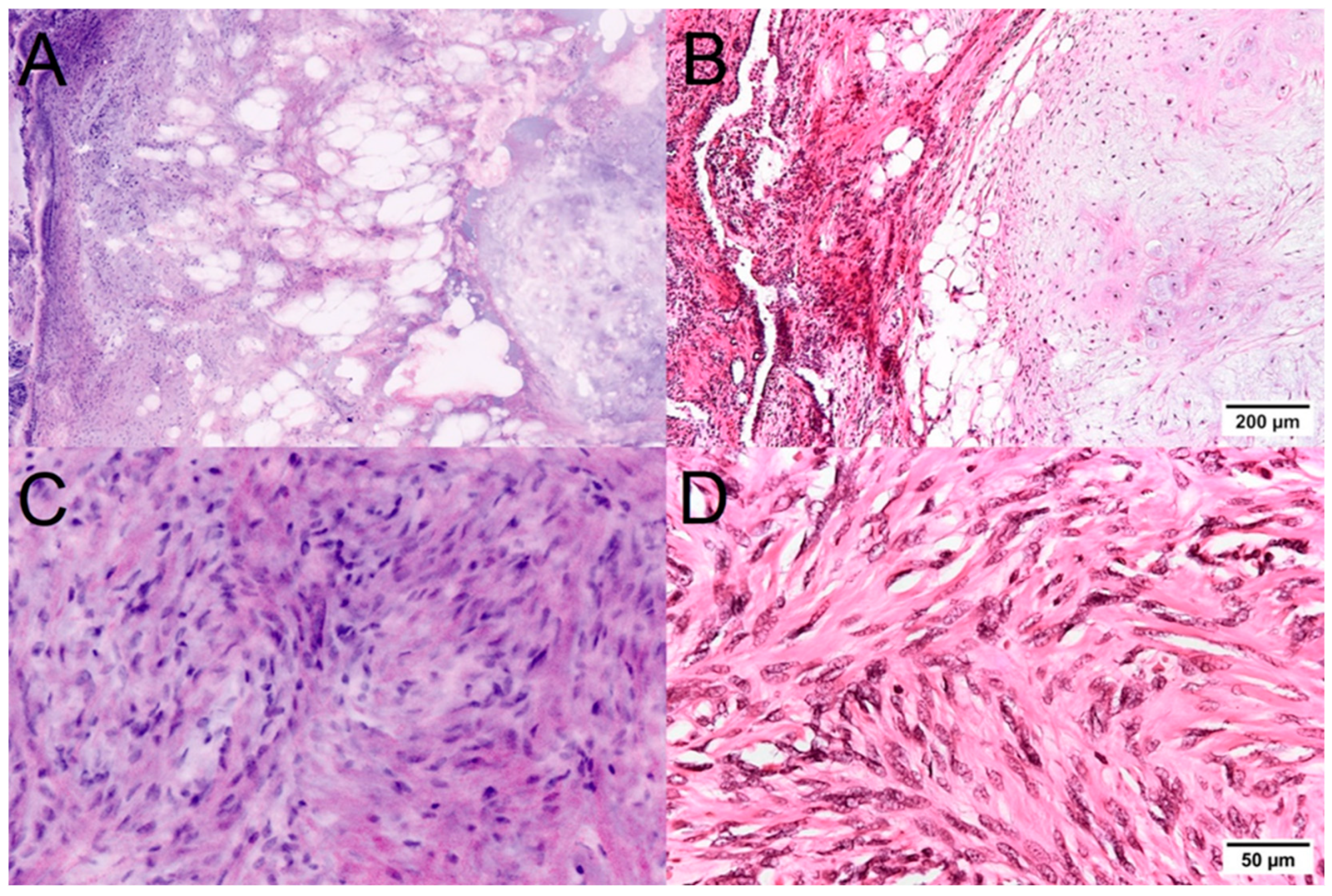 Cancers 16 02221 g004