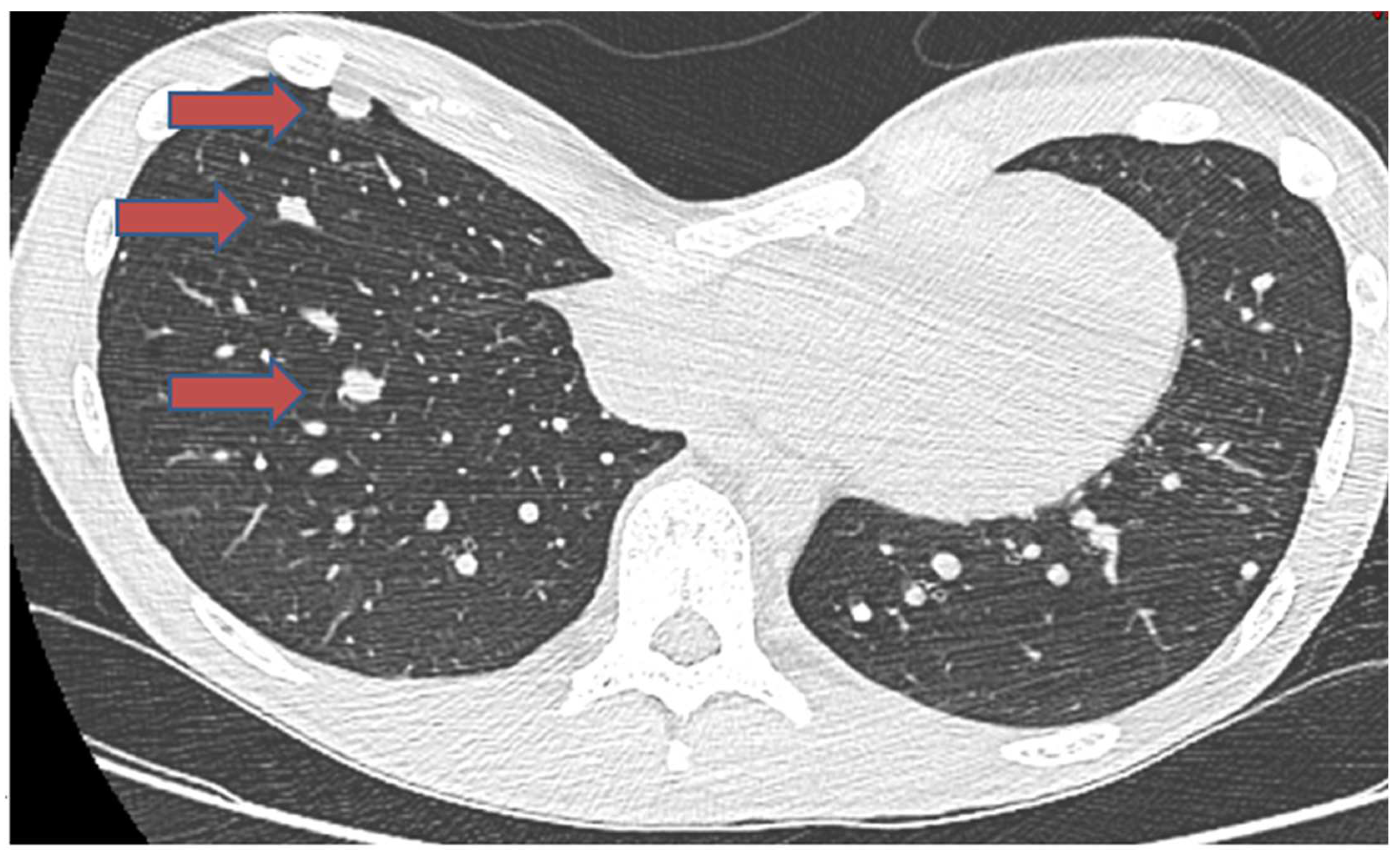 Cancers 16 02283 g003