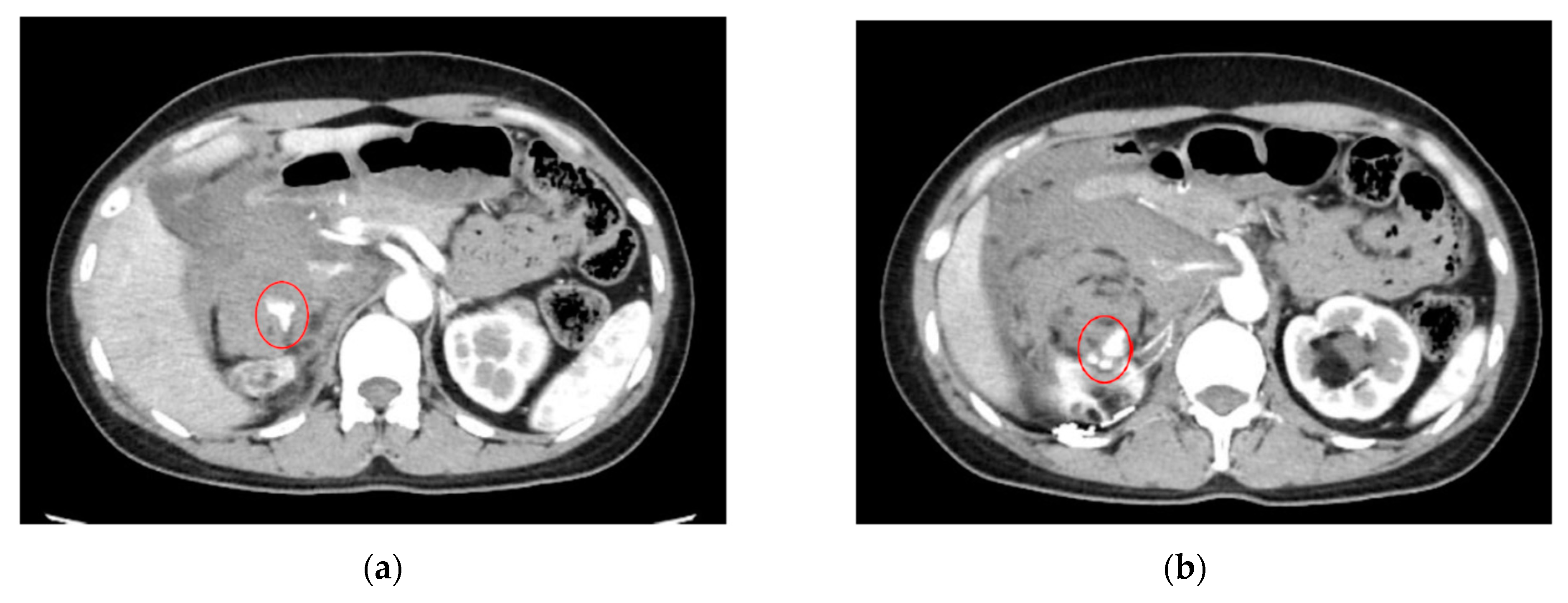 Cancers 16 02308 g004