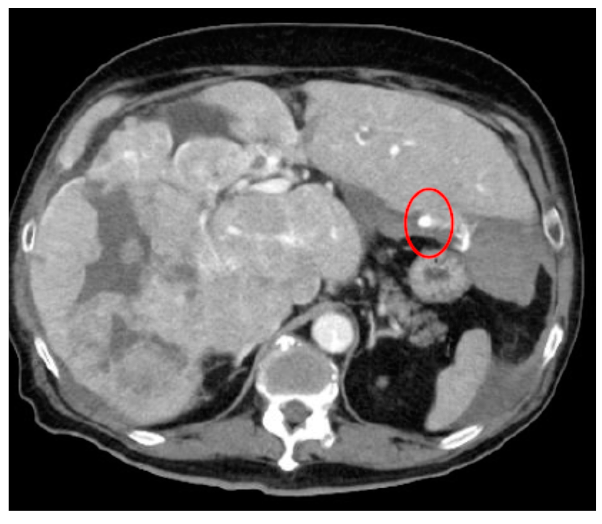 Cancers 16 02308 g005