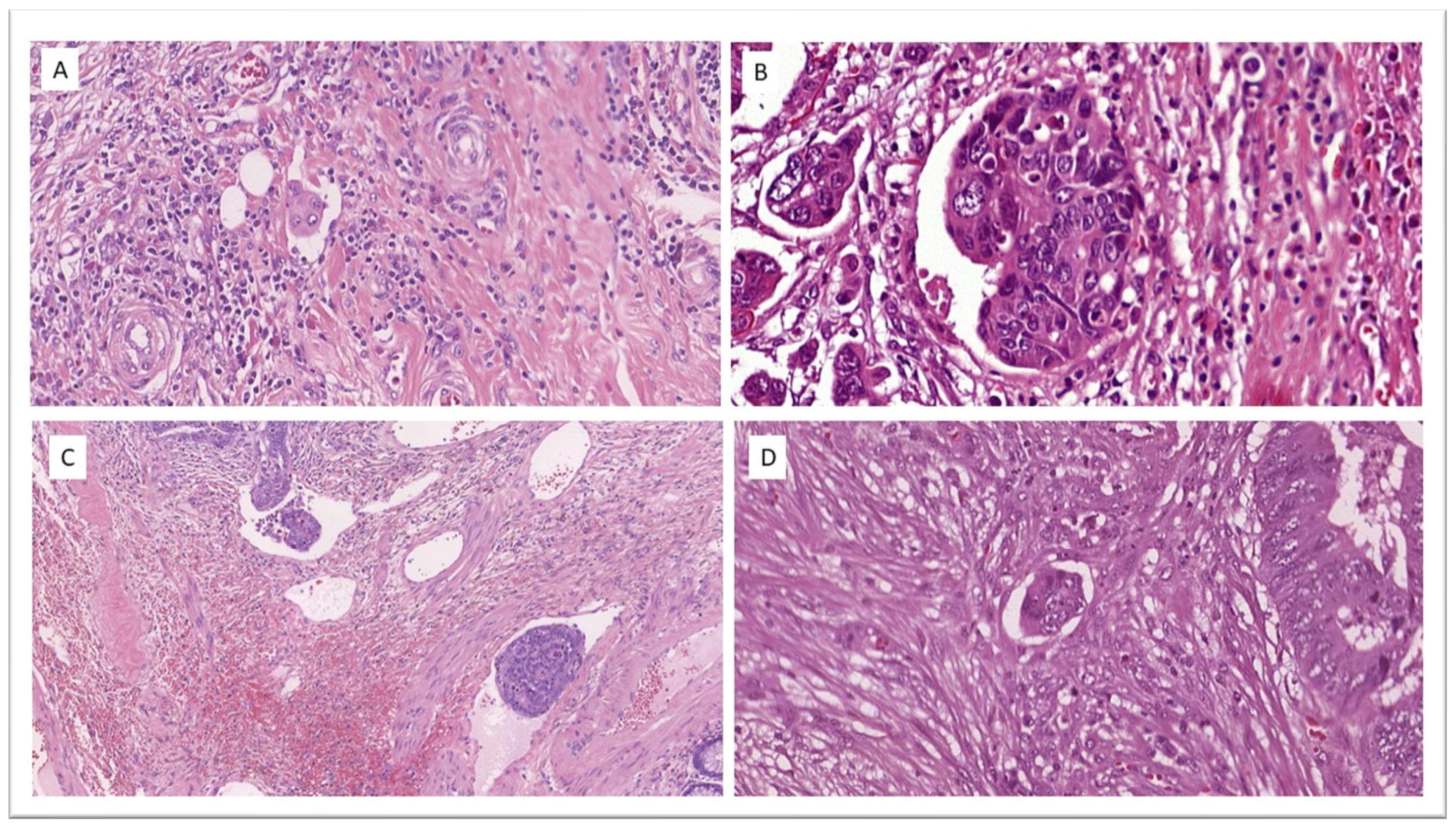 Cancers 16 02321 g003