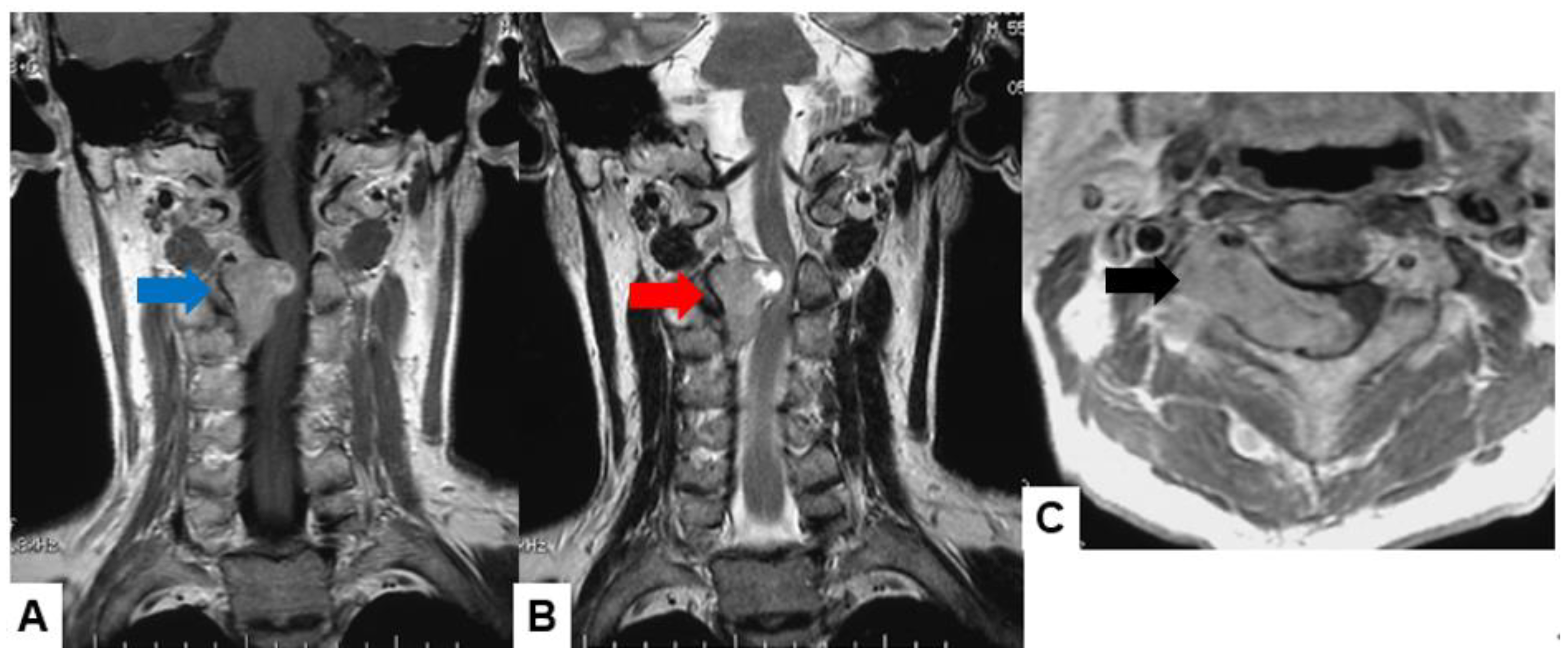 Cancers 16 02360 g002