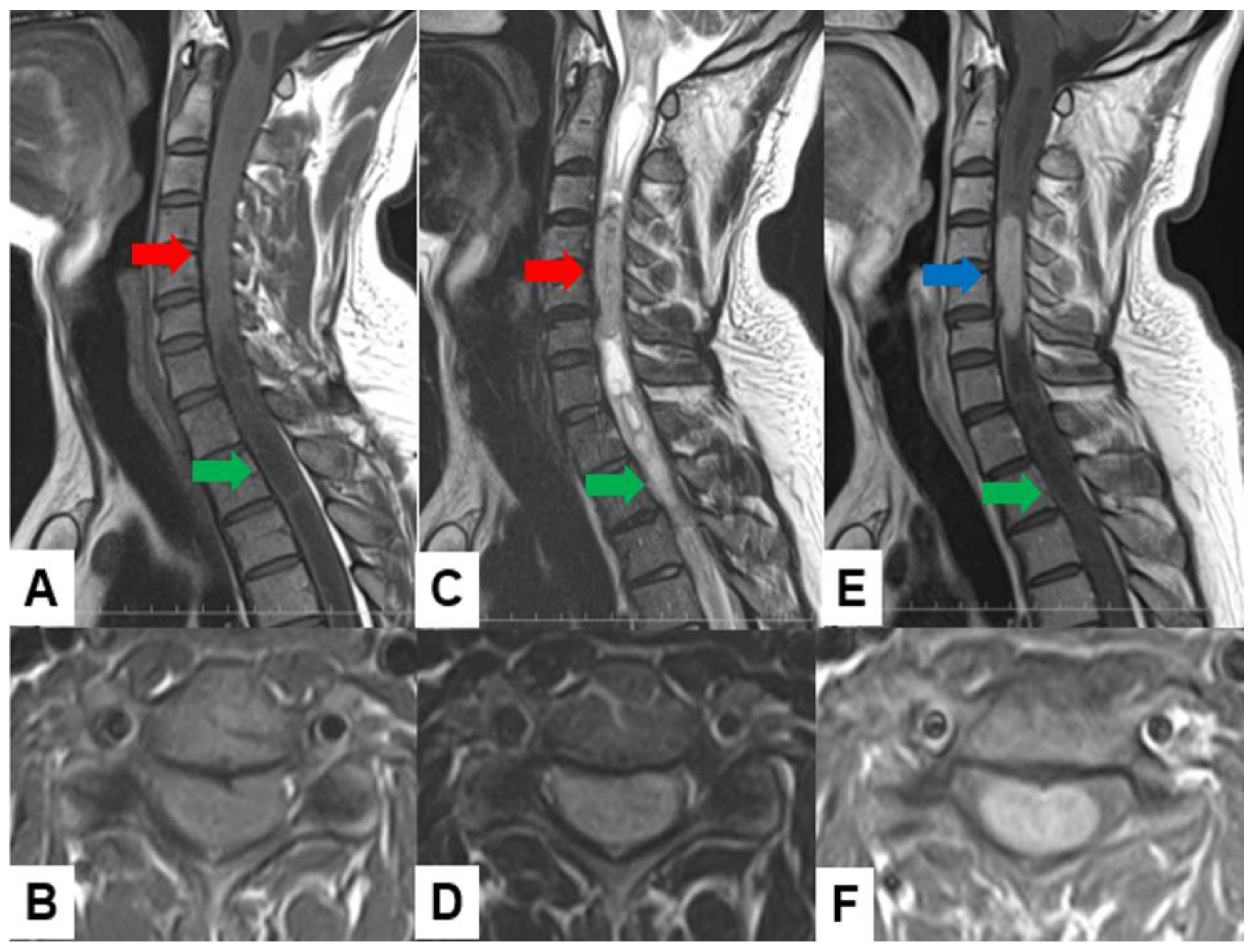 Cancers 16 02360 g006