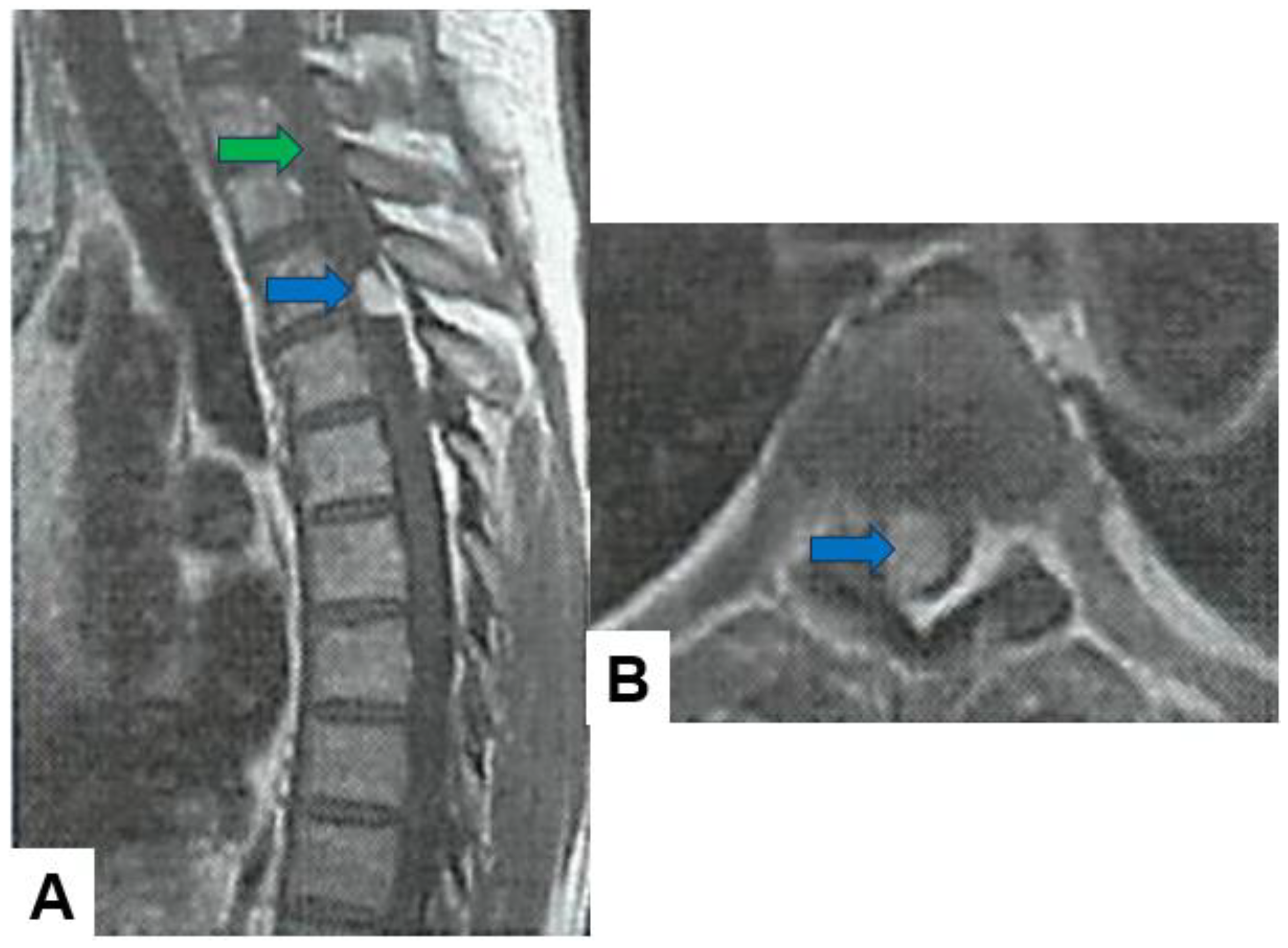 Cancers 16 02360 g007